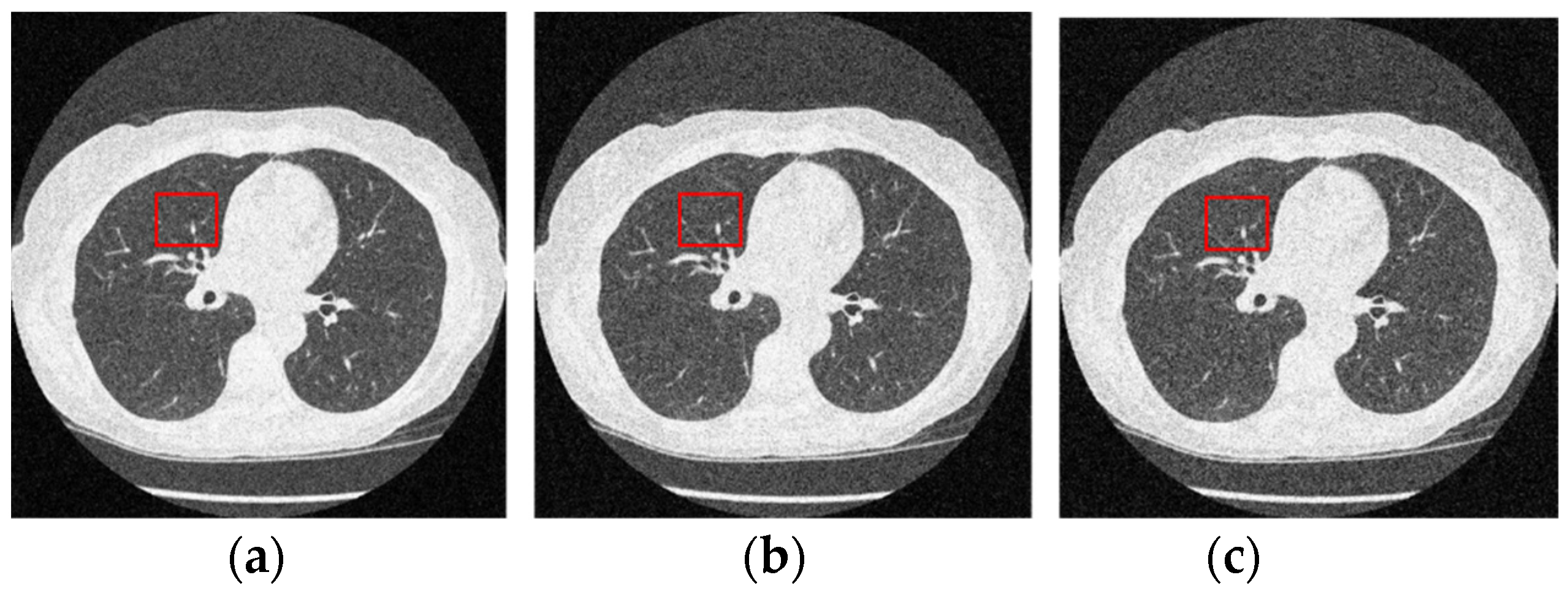Electronics Free FullText A Method NoiseBased Convolutional