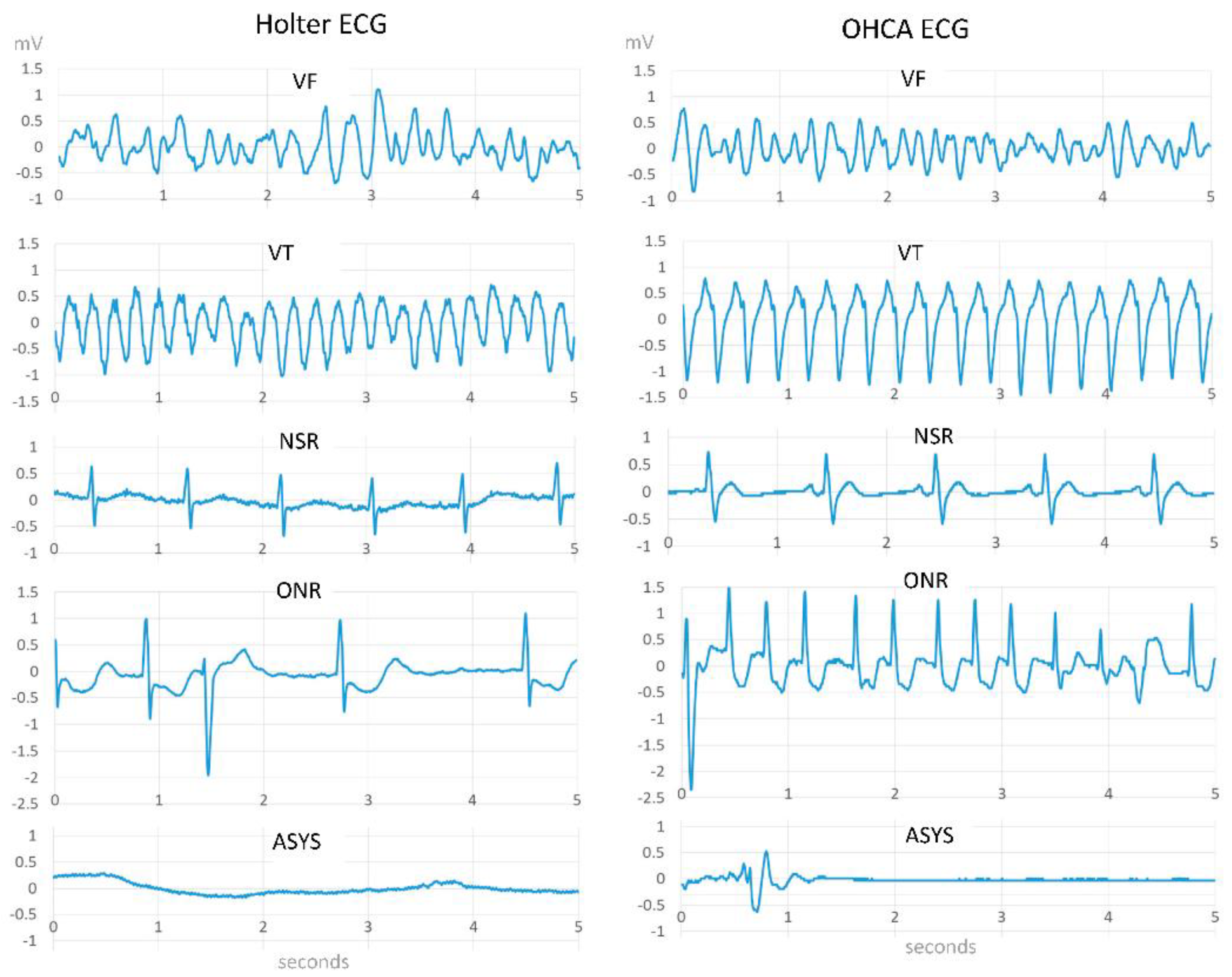 The Aed Detects A Shockable Rhythm Infant Online