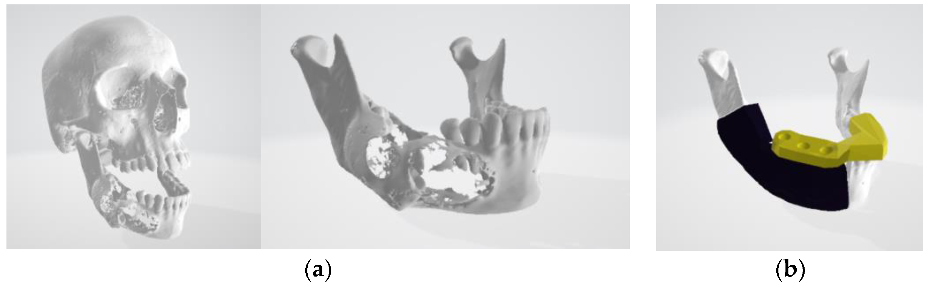 Electronics 11 03778 g008