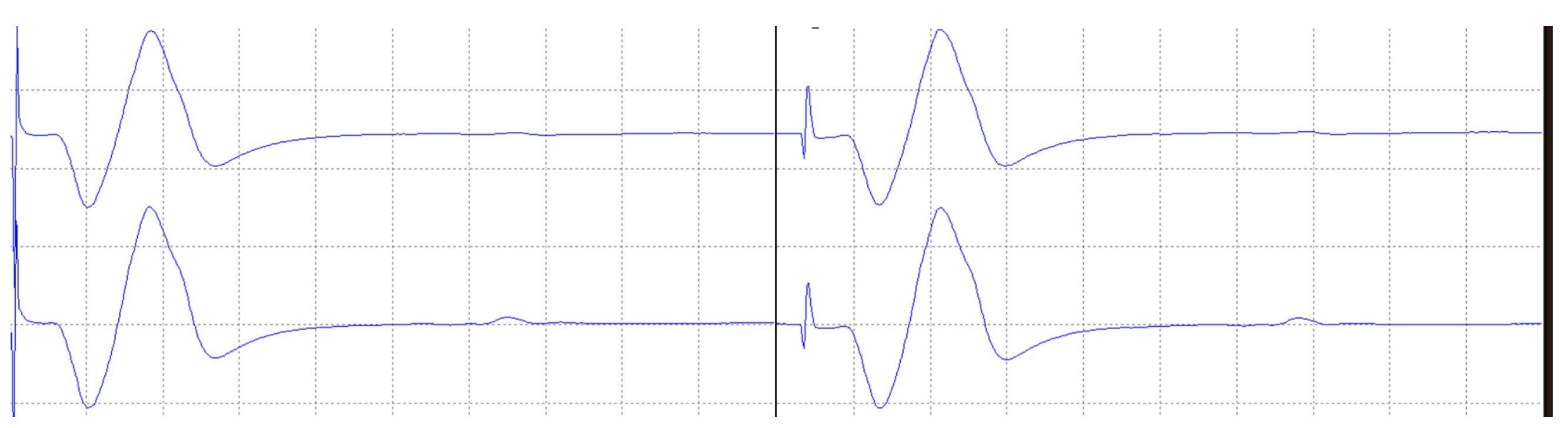 Electronics 11 03918 g014