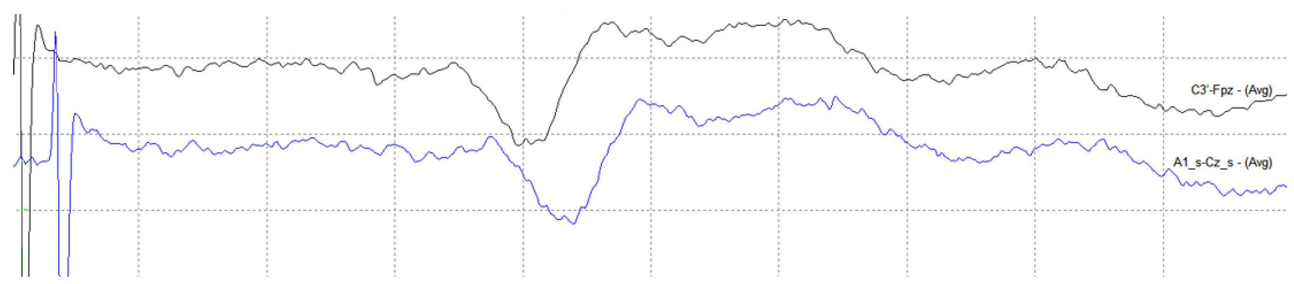 Electronics 11 03918 g016