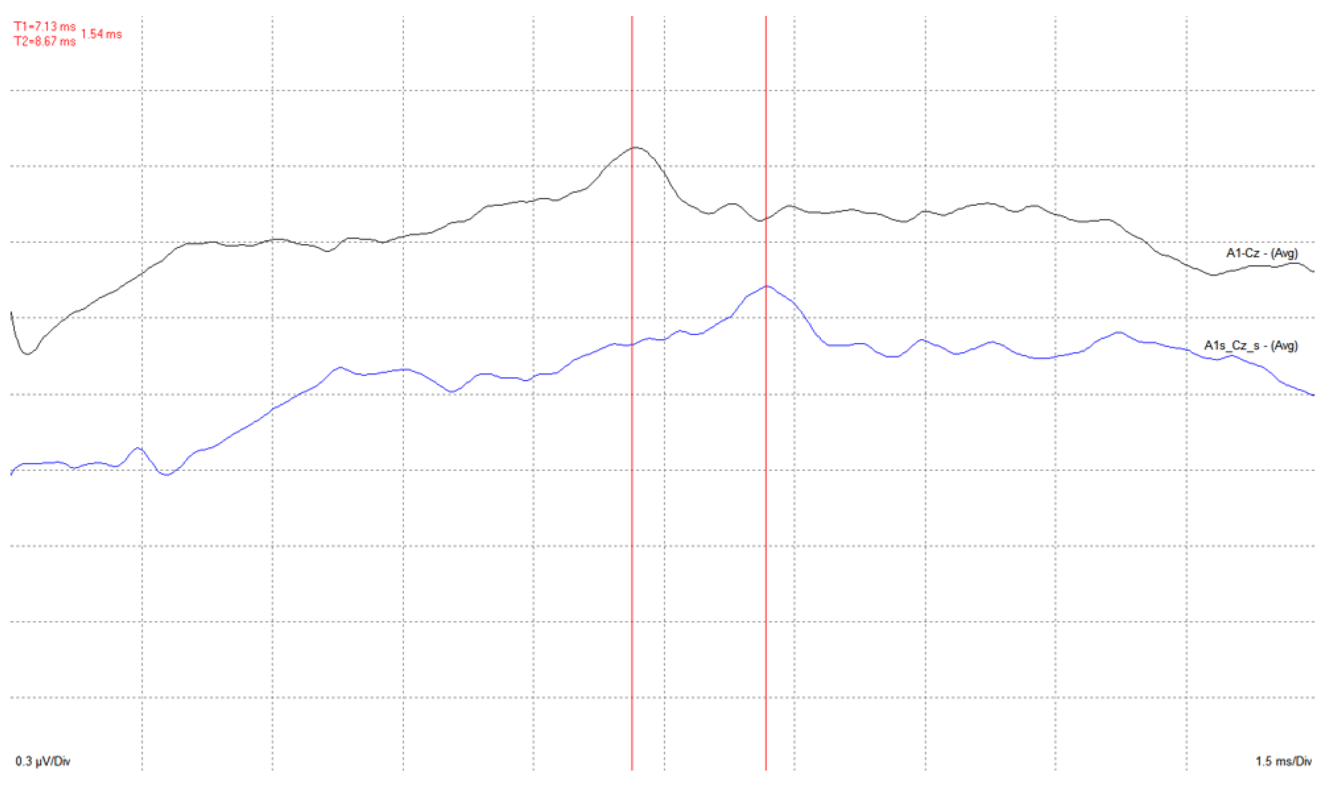 Electronics 11 03918 g017