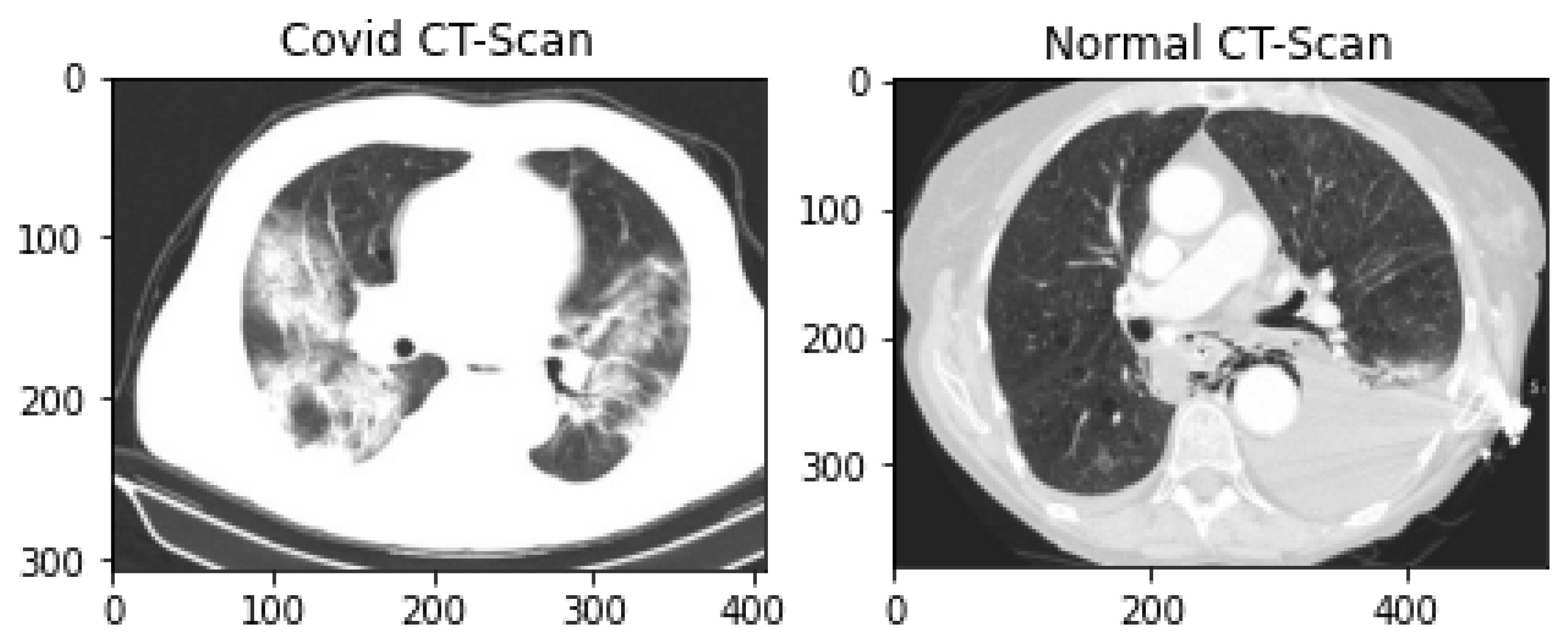 Detection of Diseases in Pandemic: A Predictive Approach Using Stack ...