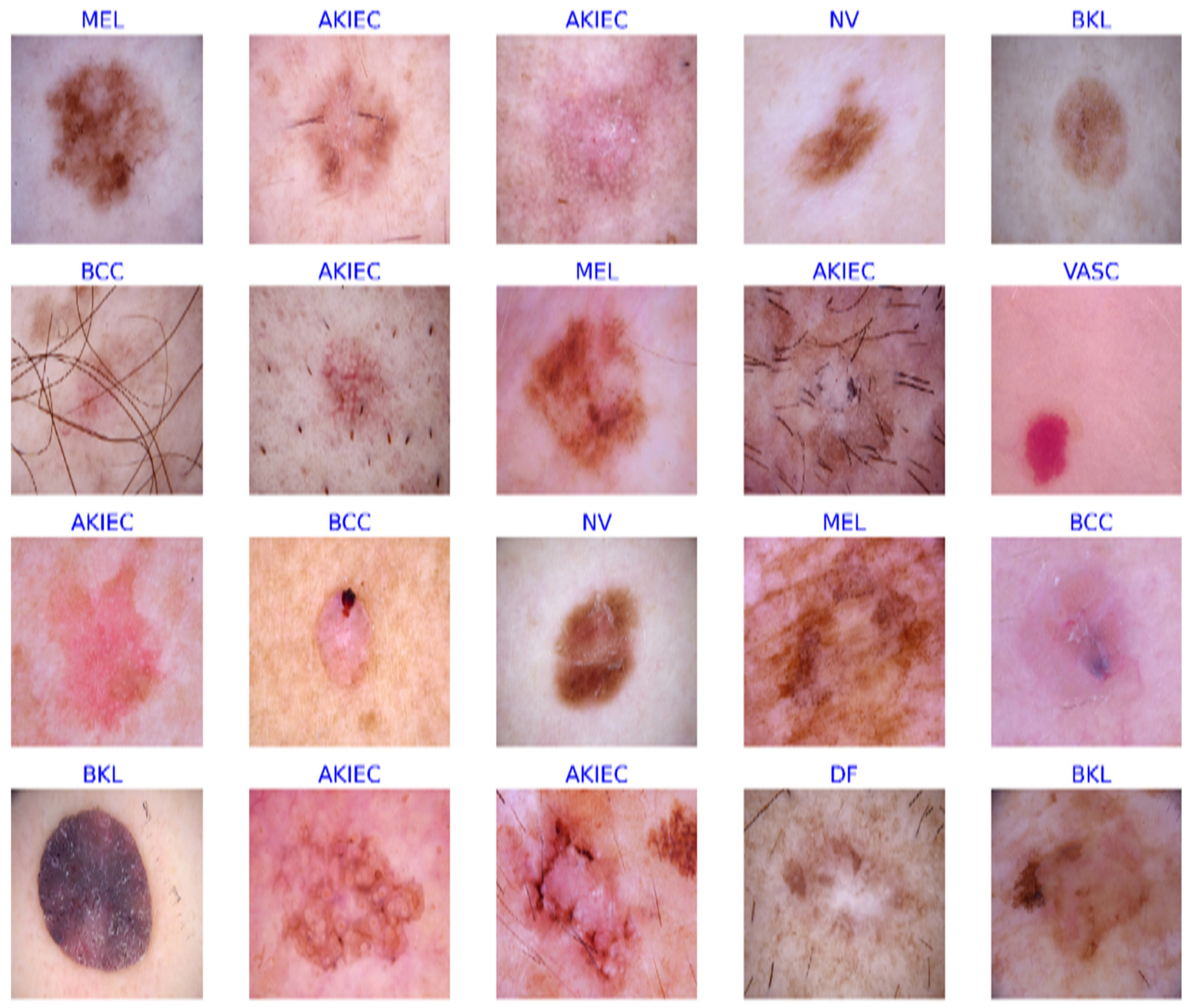 Skin disorders cheap