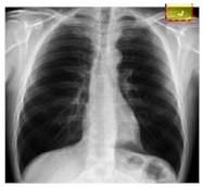 Electronics 11 04053 i001