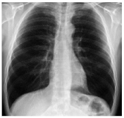 Electronics 11 04053 i003