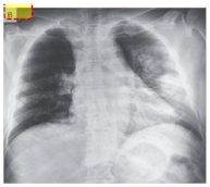 Electronics 11 04053 i004