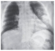 Electronics 11 04053 i005