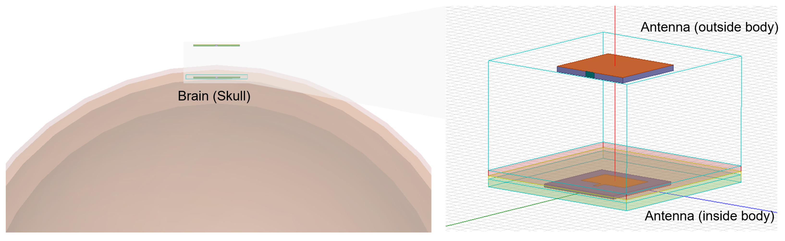 Electronics 11 04197 g008 Electronics 11 04197 g008
