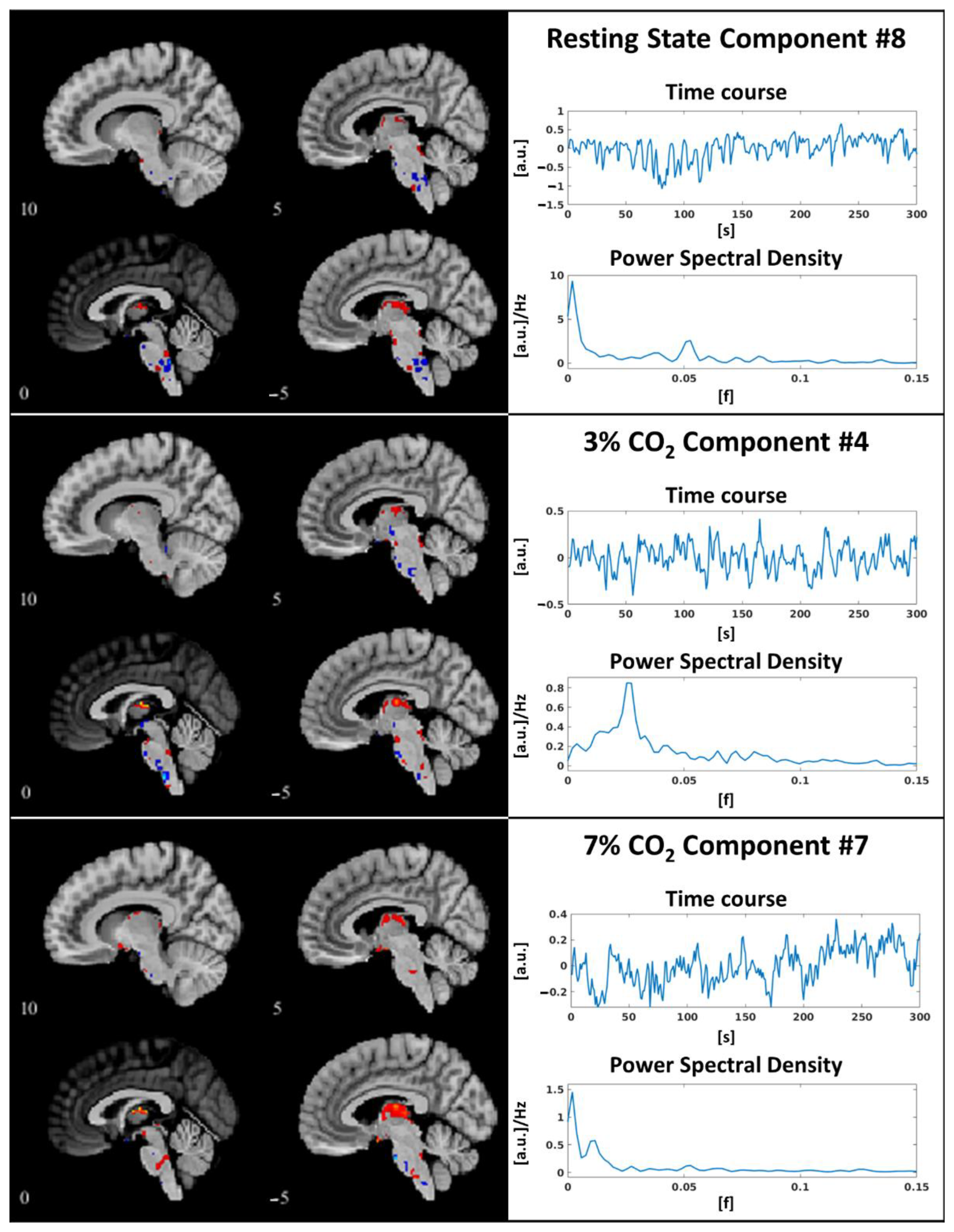 Electronics 12 00290 g004