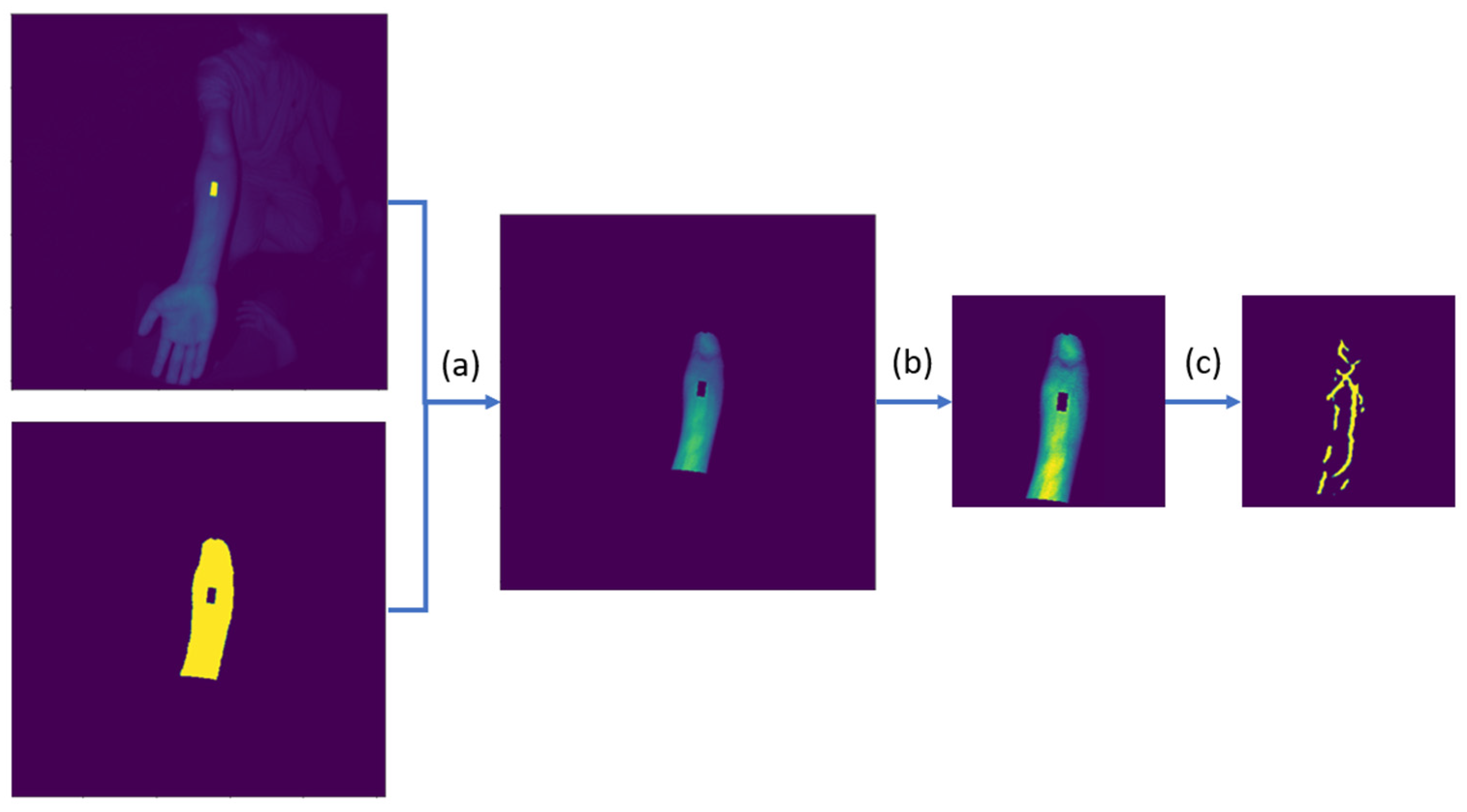 Electronics 12 00292 g004