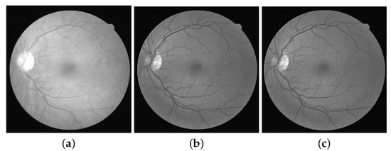 Impact of Retinal Vessel Image Coherence on Retinal Blood Vessel ...