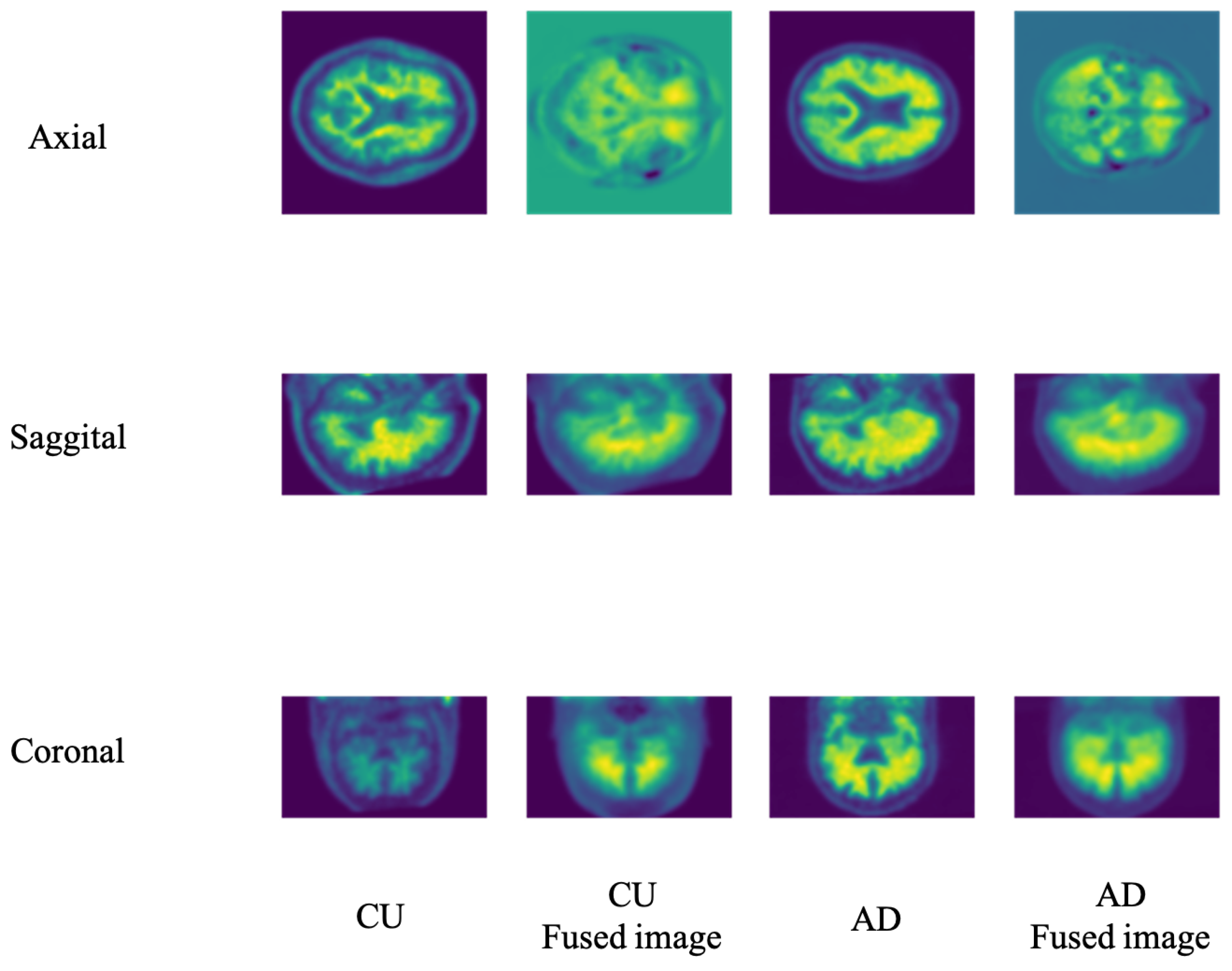 Electronics 12 00467 g004