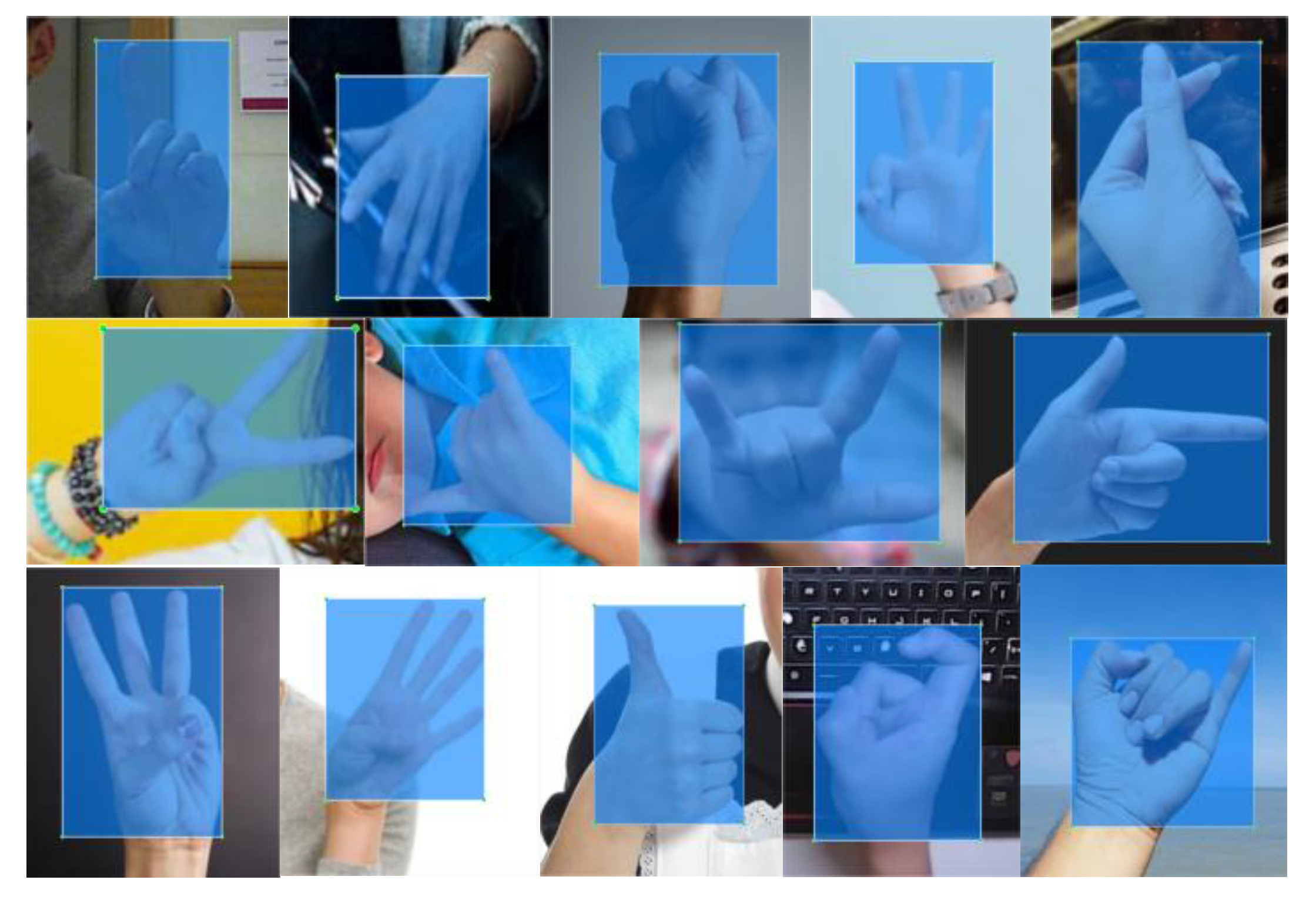 Static Gesture Recognition Algorithm Based on Improved YOLOv5s