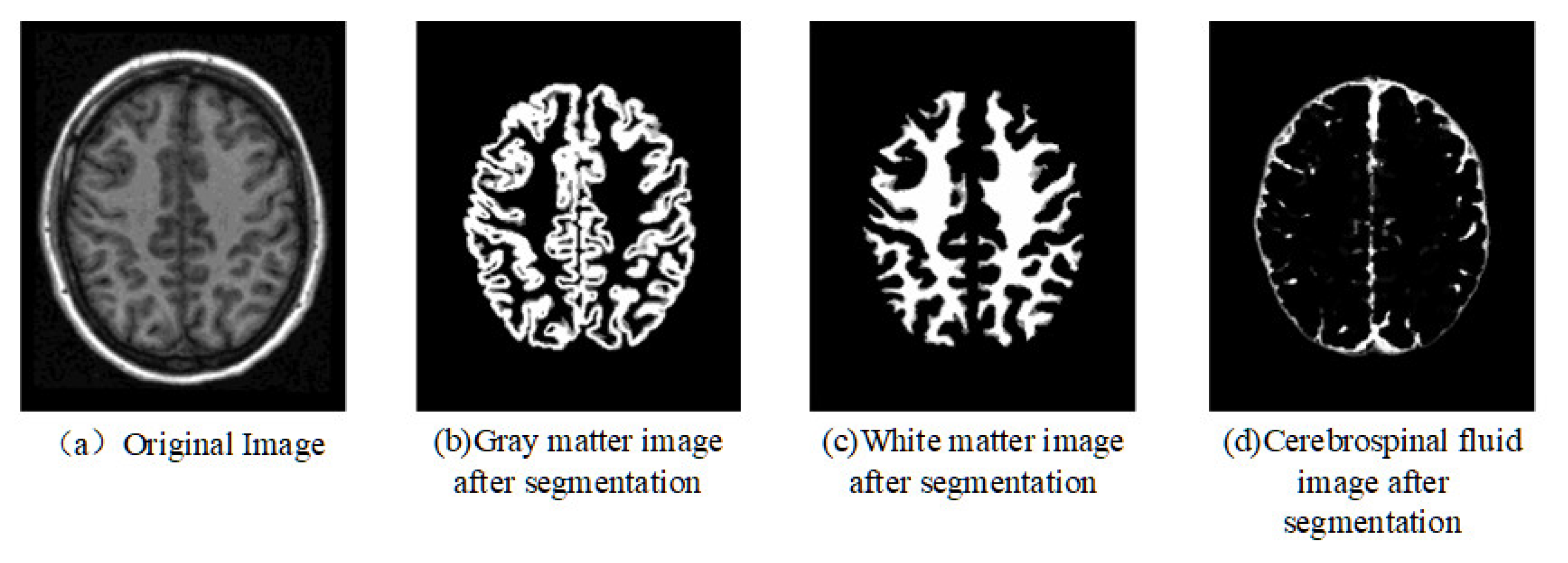 Methodological Research on Image Registration Based on Human Brain ...