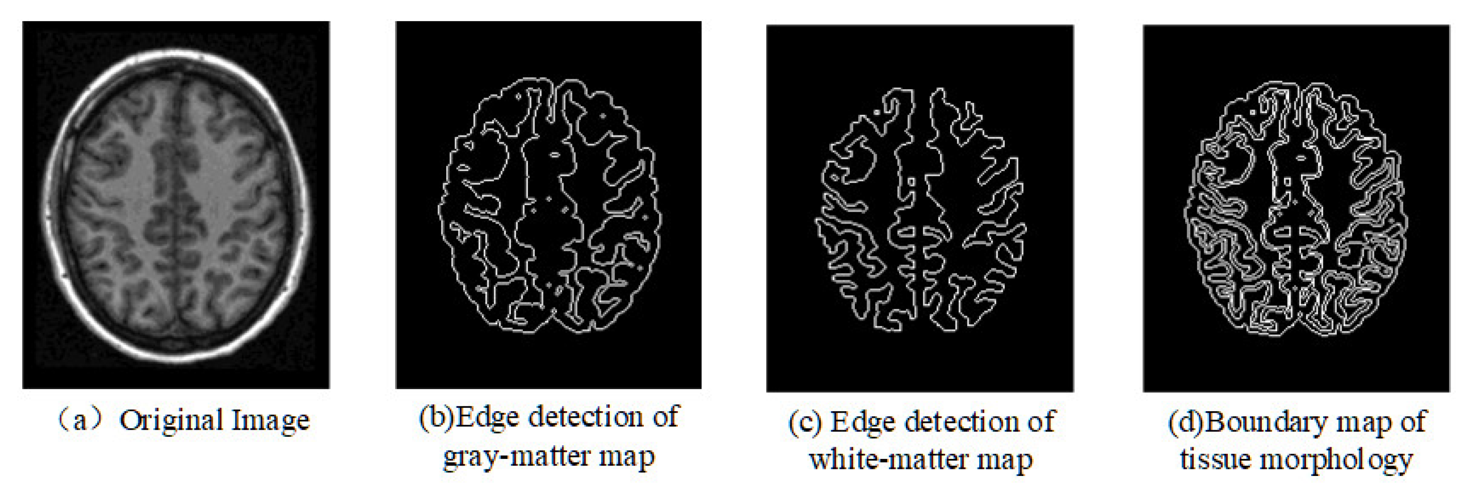 Electronics 12 00738 g003 550