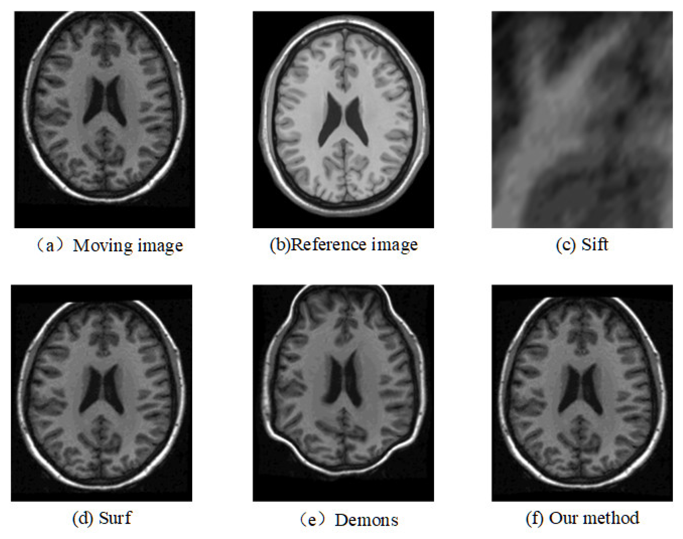 Electronics 12 00738 g008 550