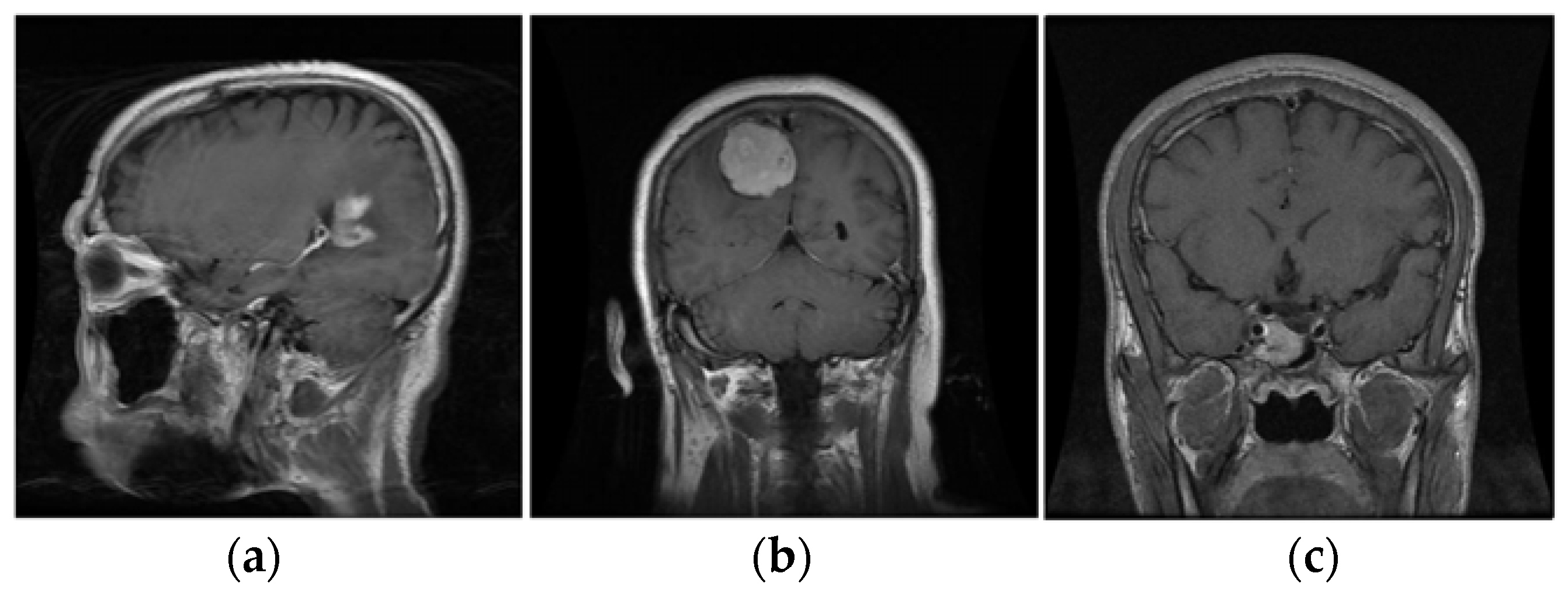 Electronics 12 00964 g004 Electronics 12 00964 g004