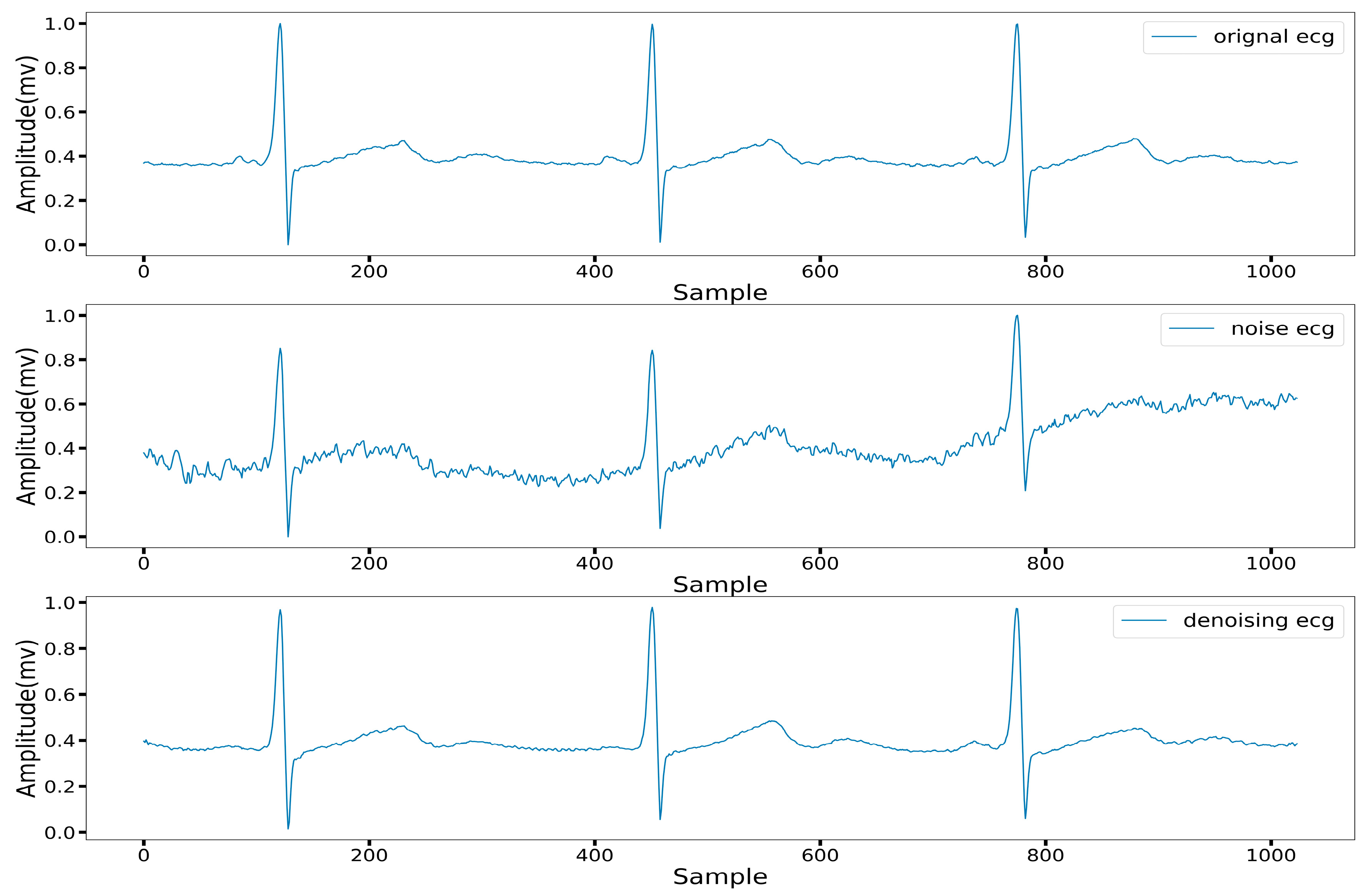 ECG Signal Denoising Method Based on Disentangled Autoencoder