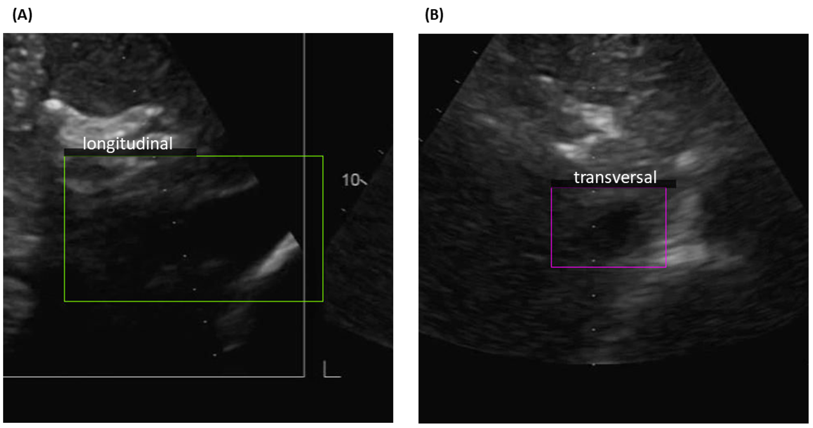 Electronics 12 01725 g003