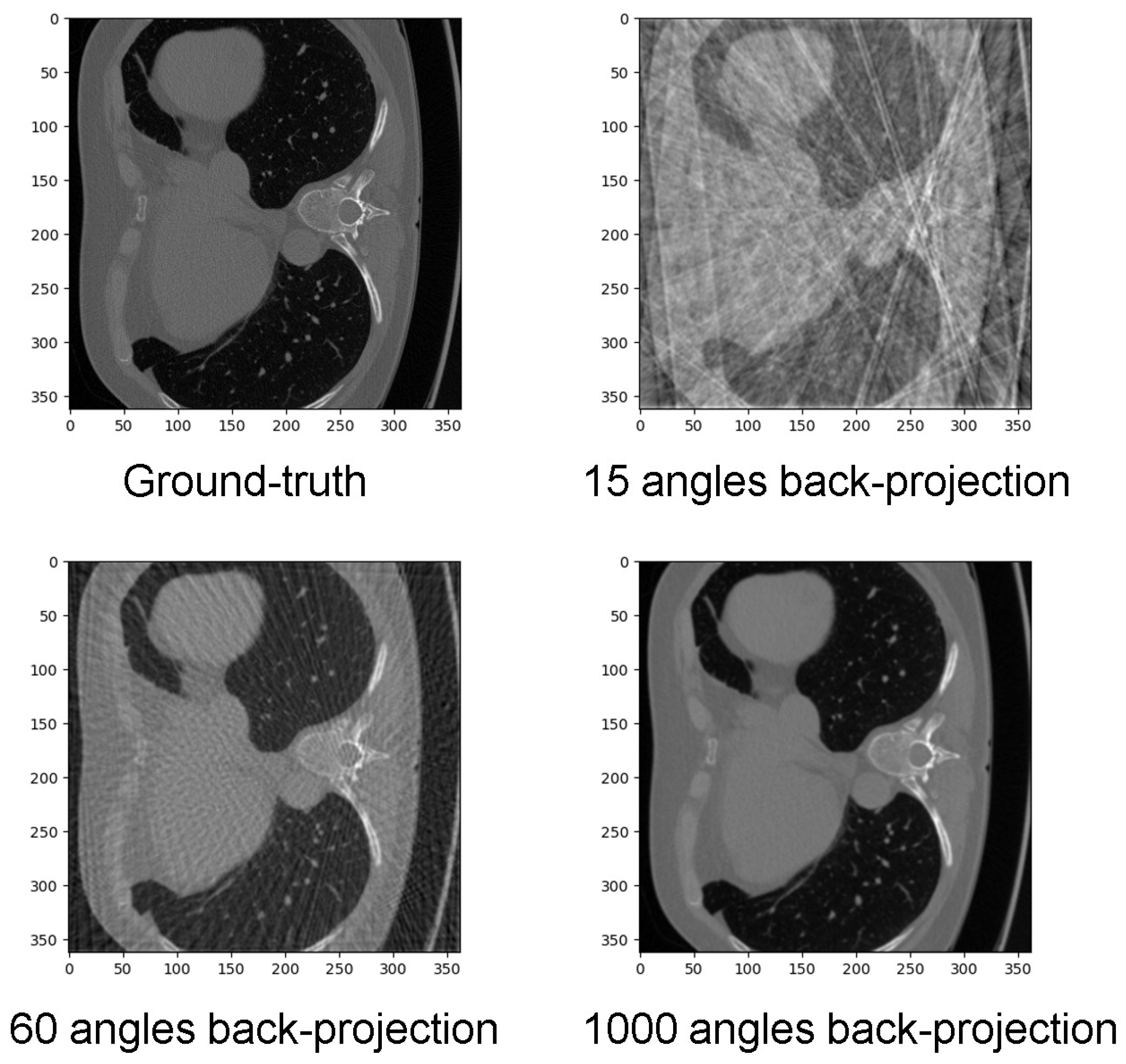 Novel Design of Industrial Real-Time CT System Based on Sparse-View ...