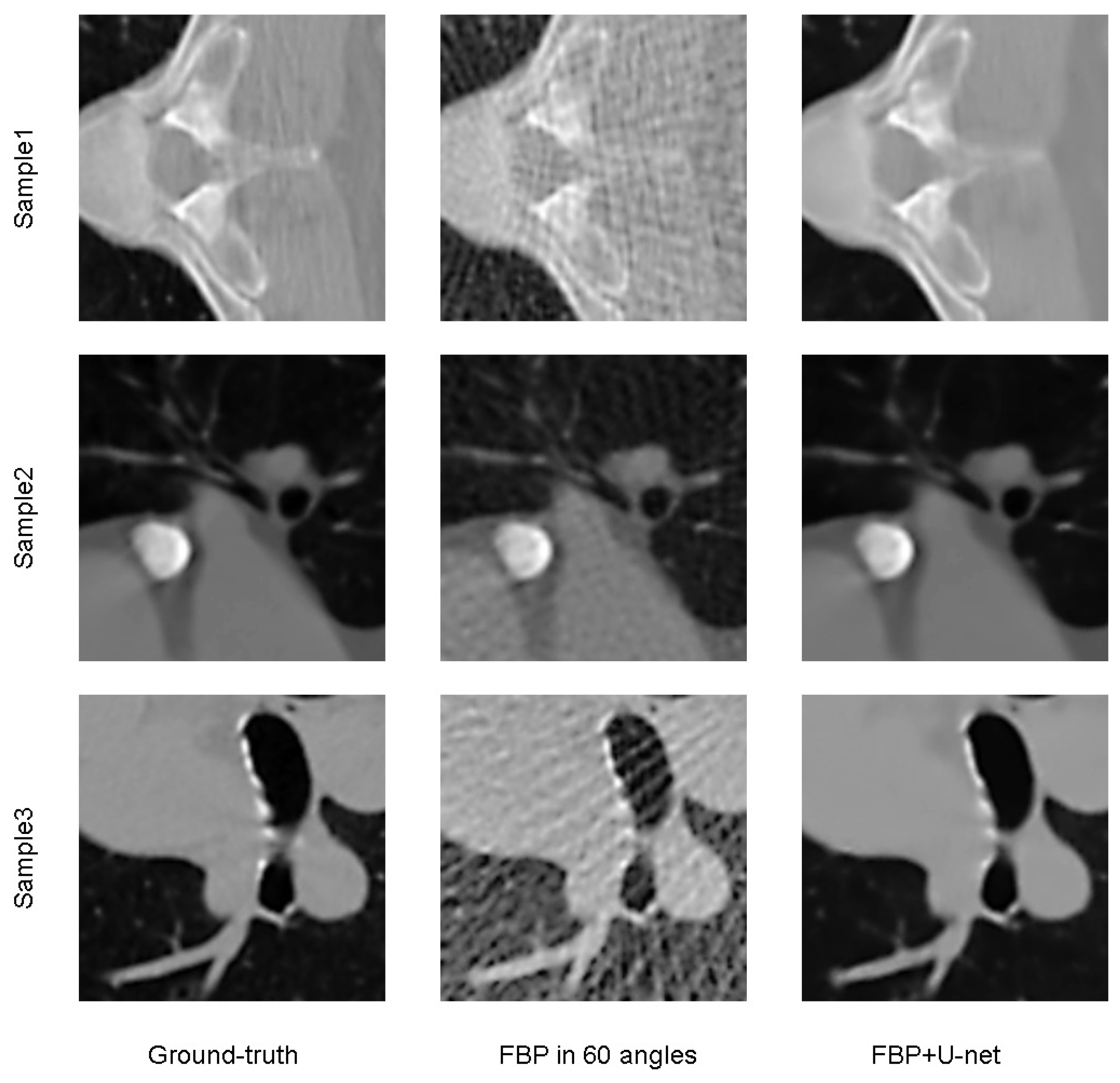 Novel Design of Industrial Real-Time CT System Based on Sparse-View ...