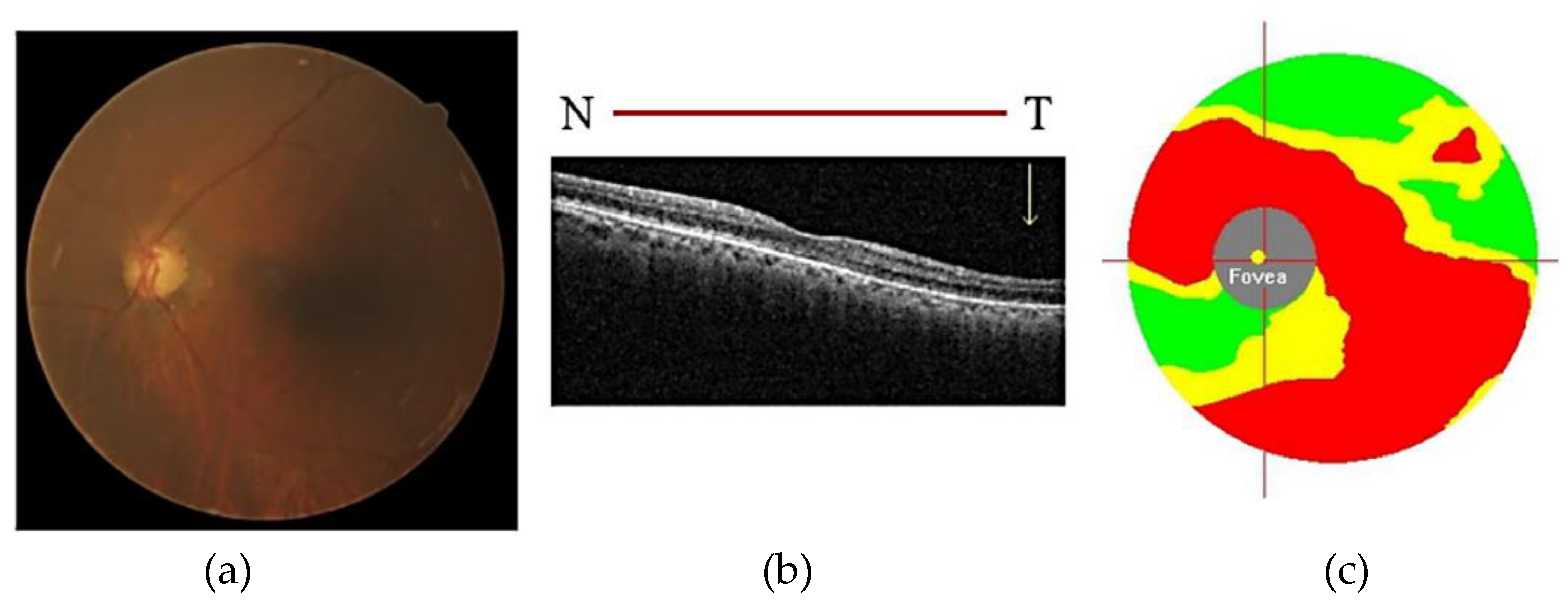 Electronics 12 02013 g006