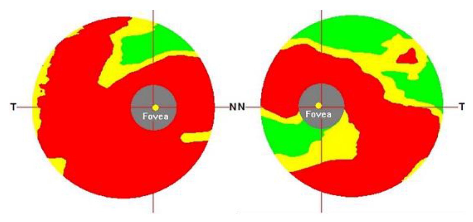 Electronics 12 02013 g009