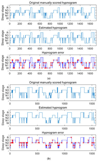 Automatic Sleep Staging Using BiRNN with Data Augmentation and Label ...
