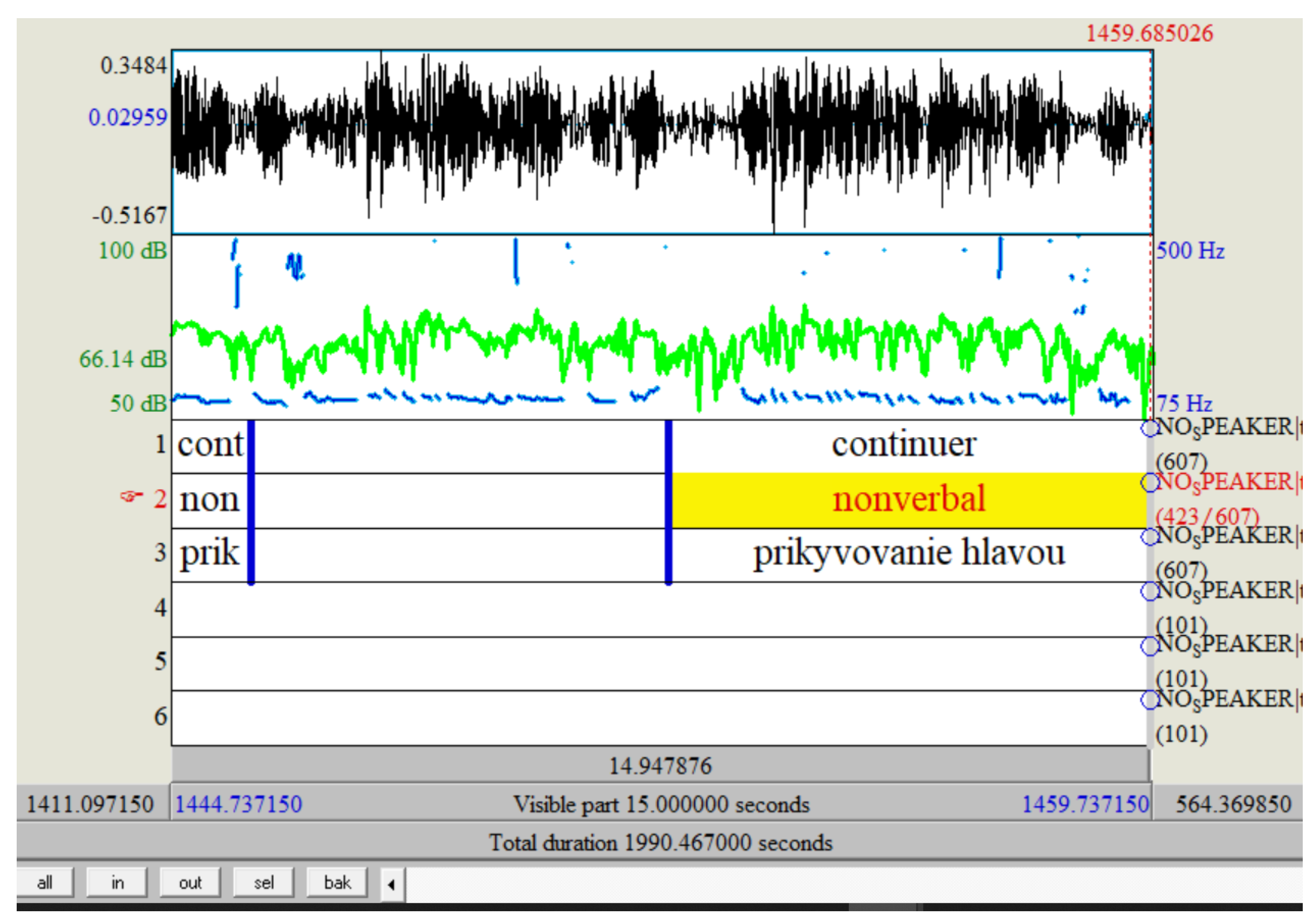 Backchannel Cues: 3 Examples That Will Shock You! - d7pcqmy