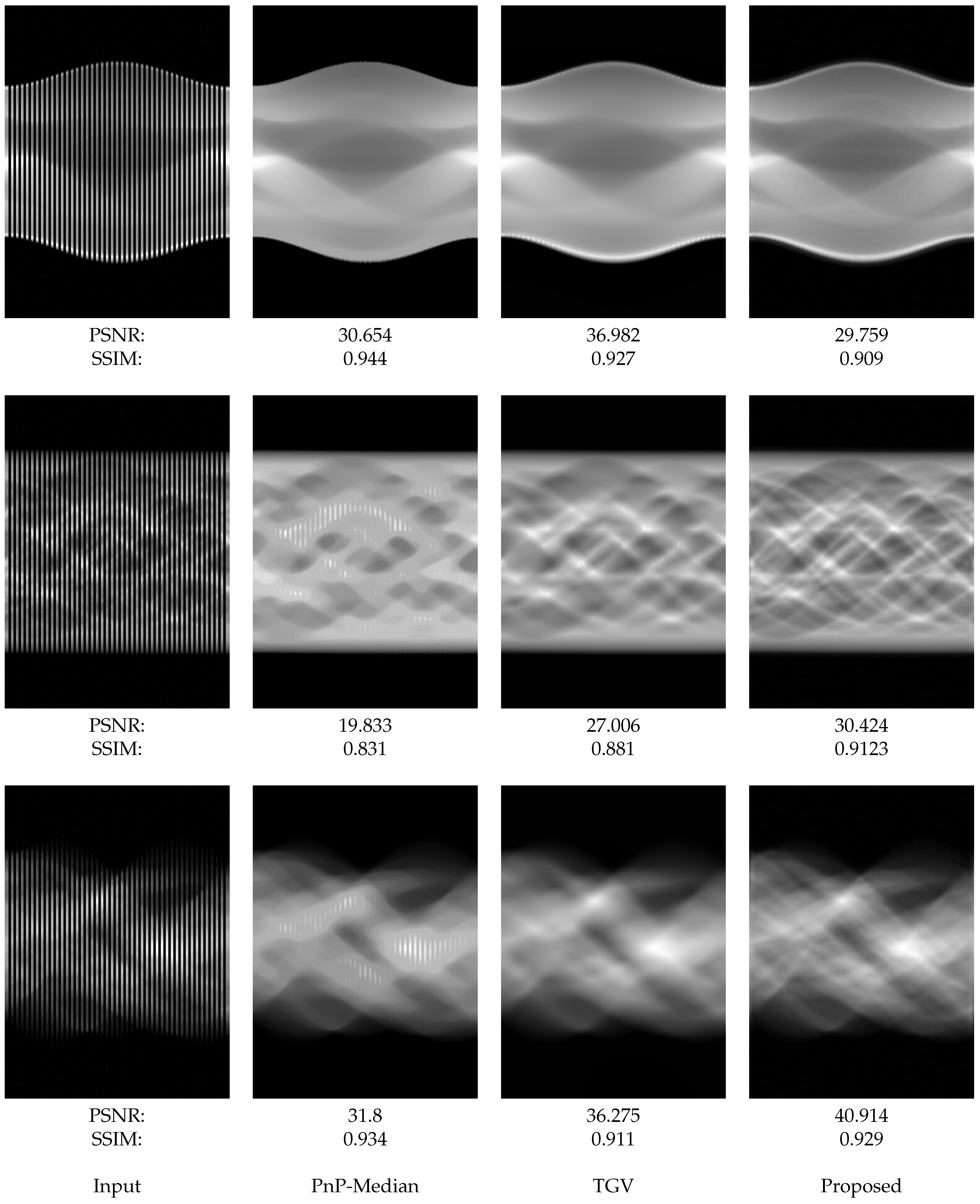 Electronics | Free Full-Text | Sinogram Upsampling via Sub-Riemannian ...