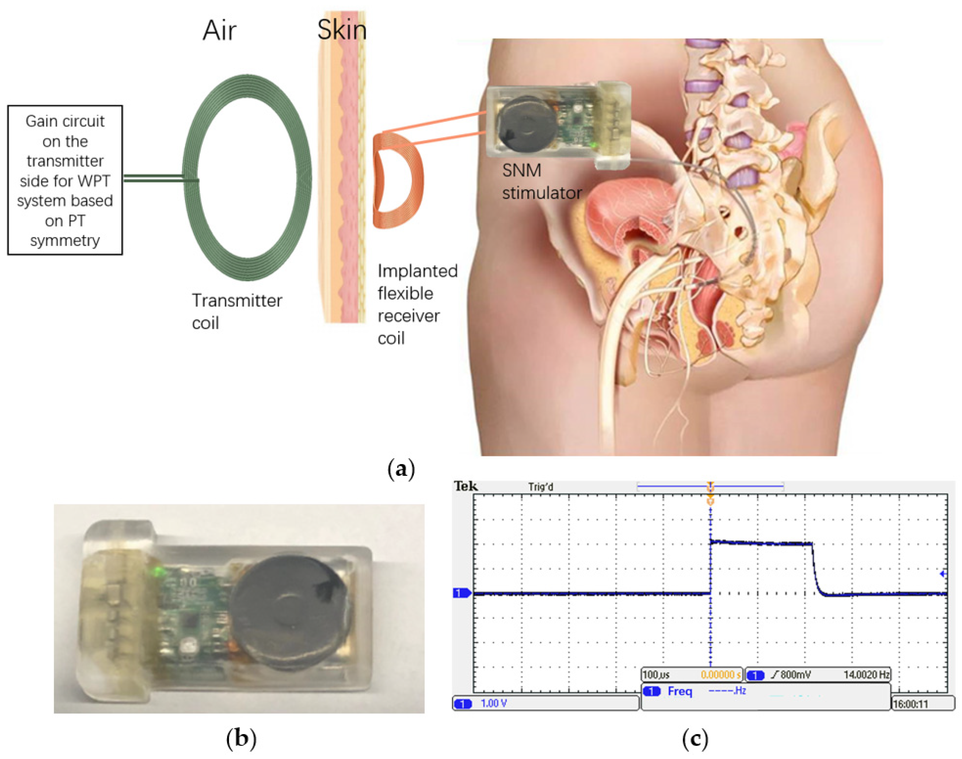 Electronics 13 00292 g009