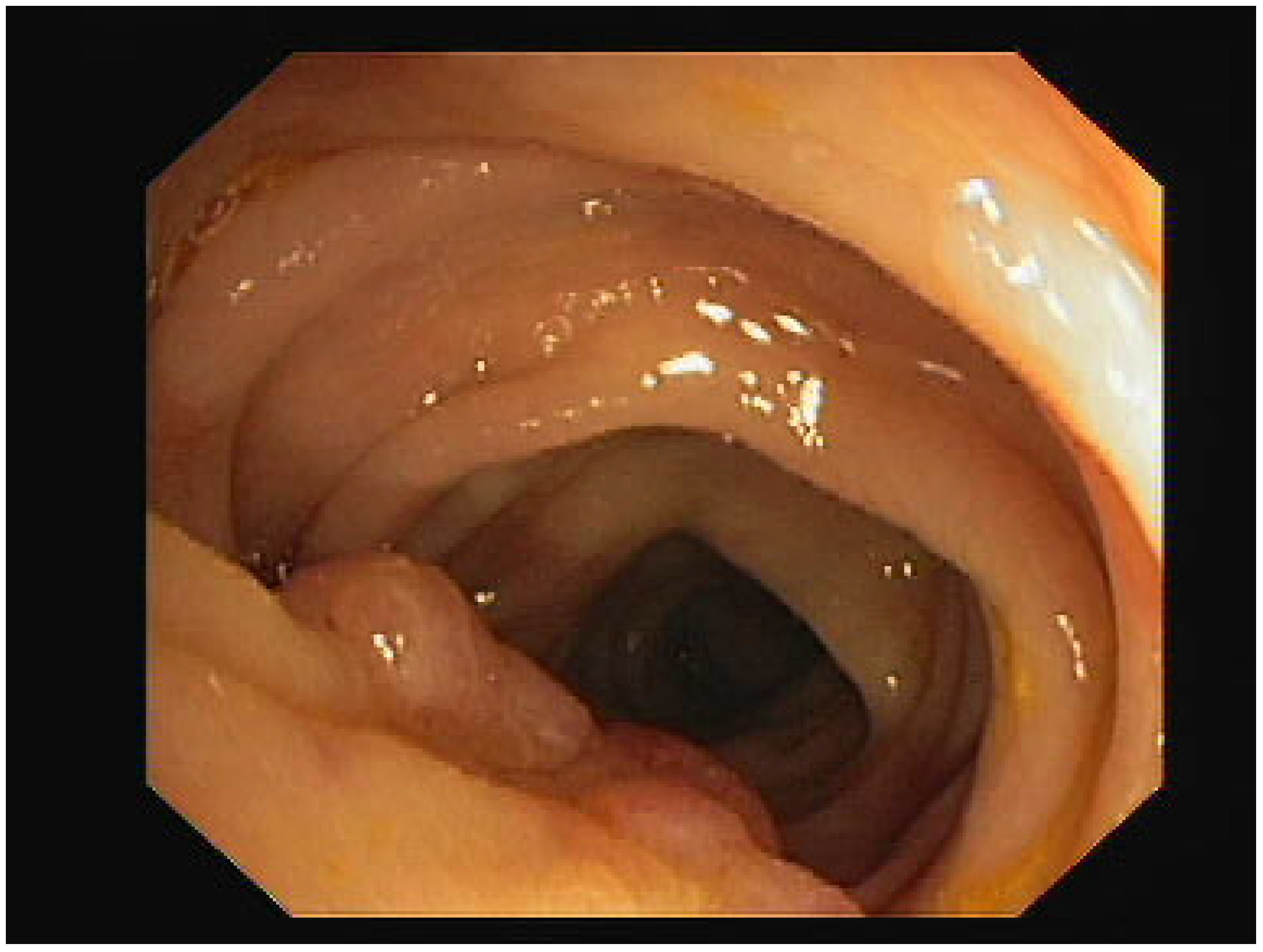 Electronics 13 00713 g003