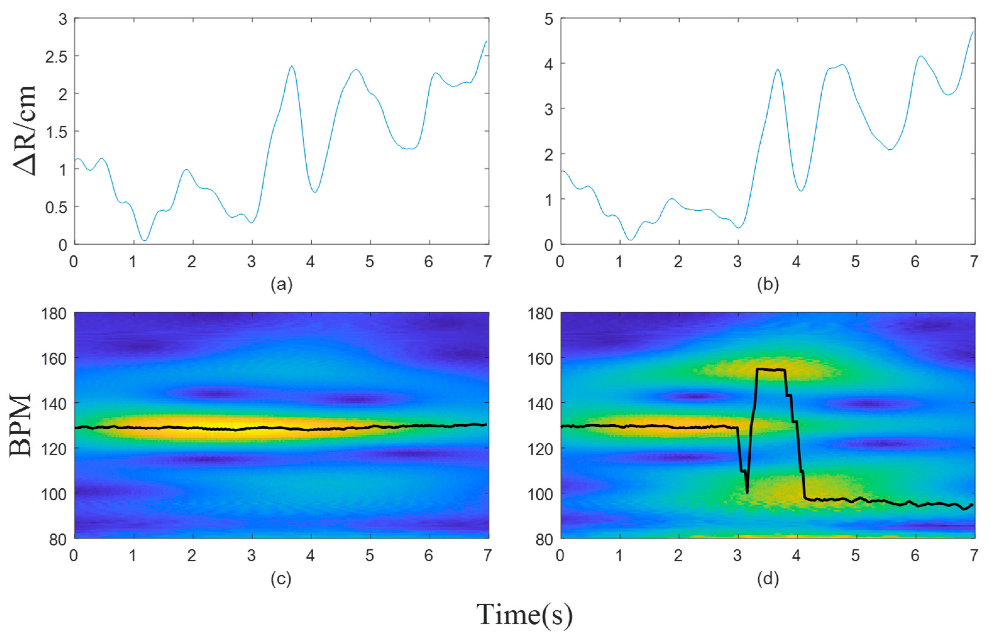 Electronics 13 01471 g004
