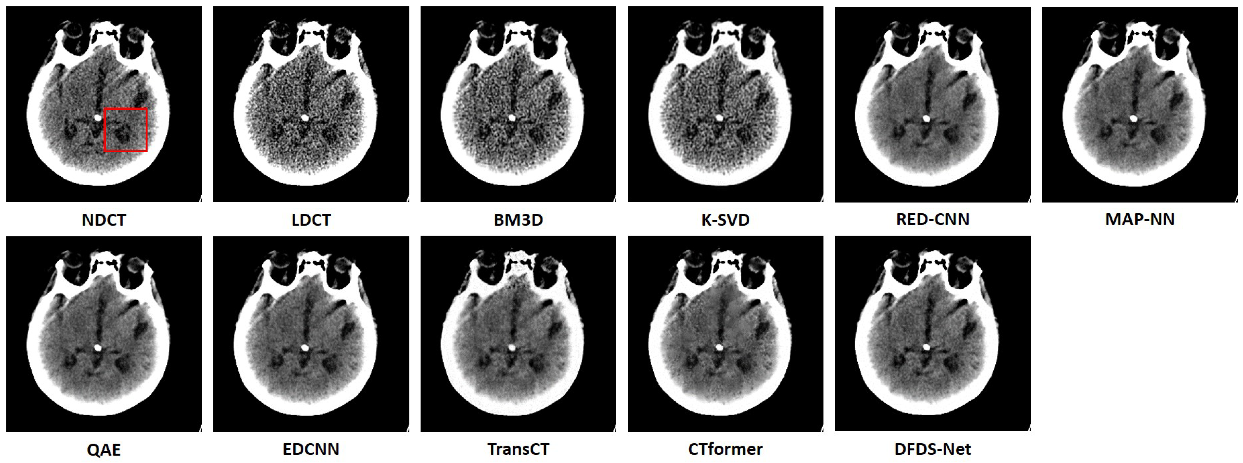 Electronics 13 01906 g005