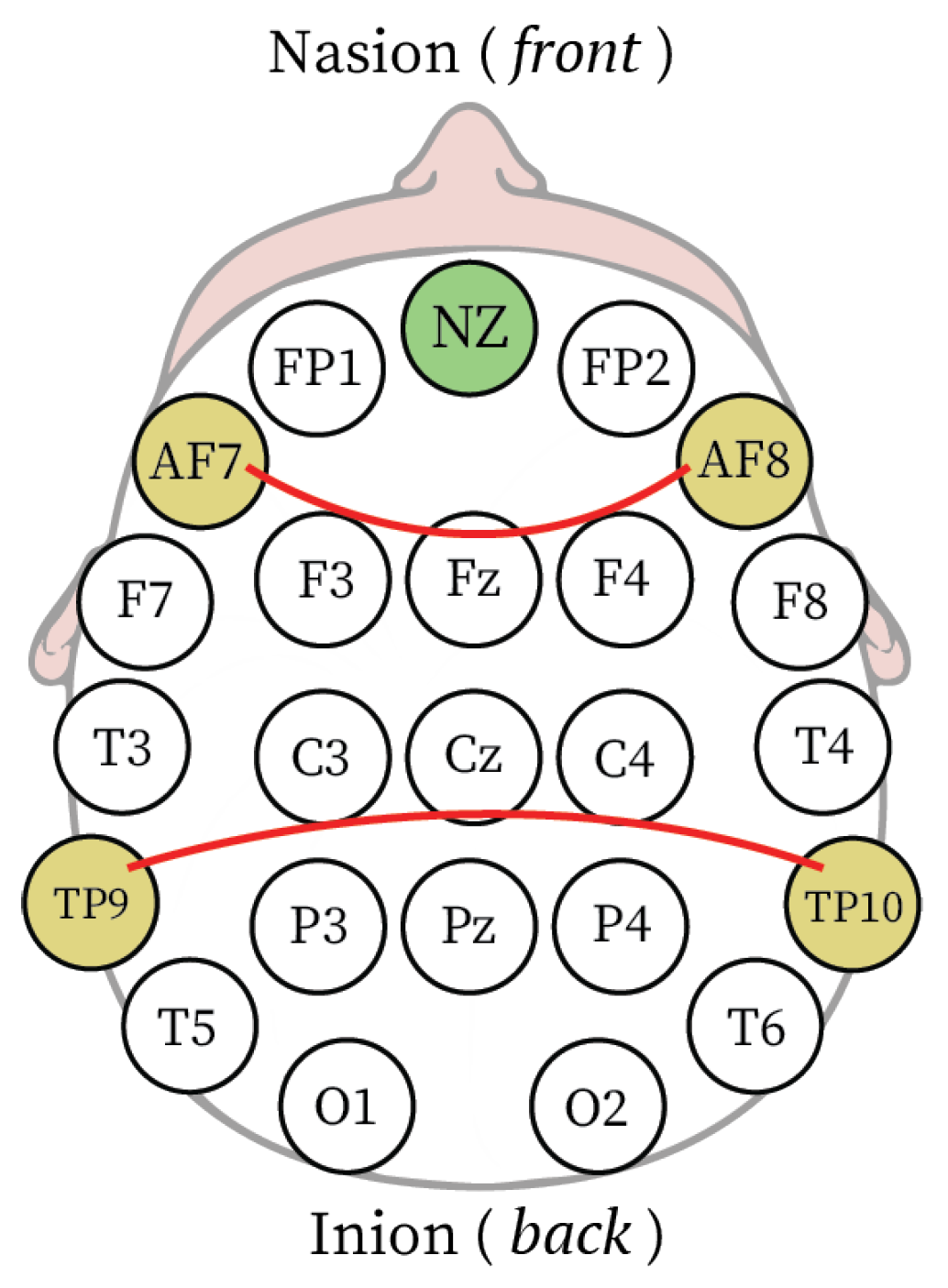 Electronics 13 02017 g004