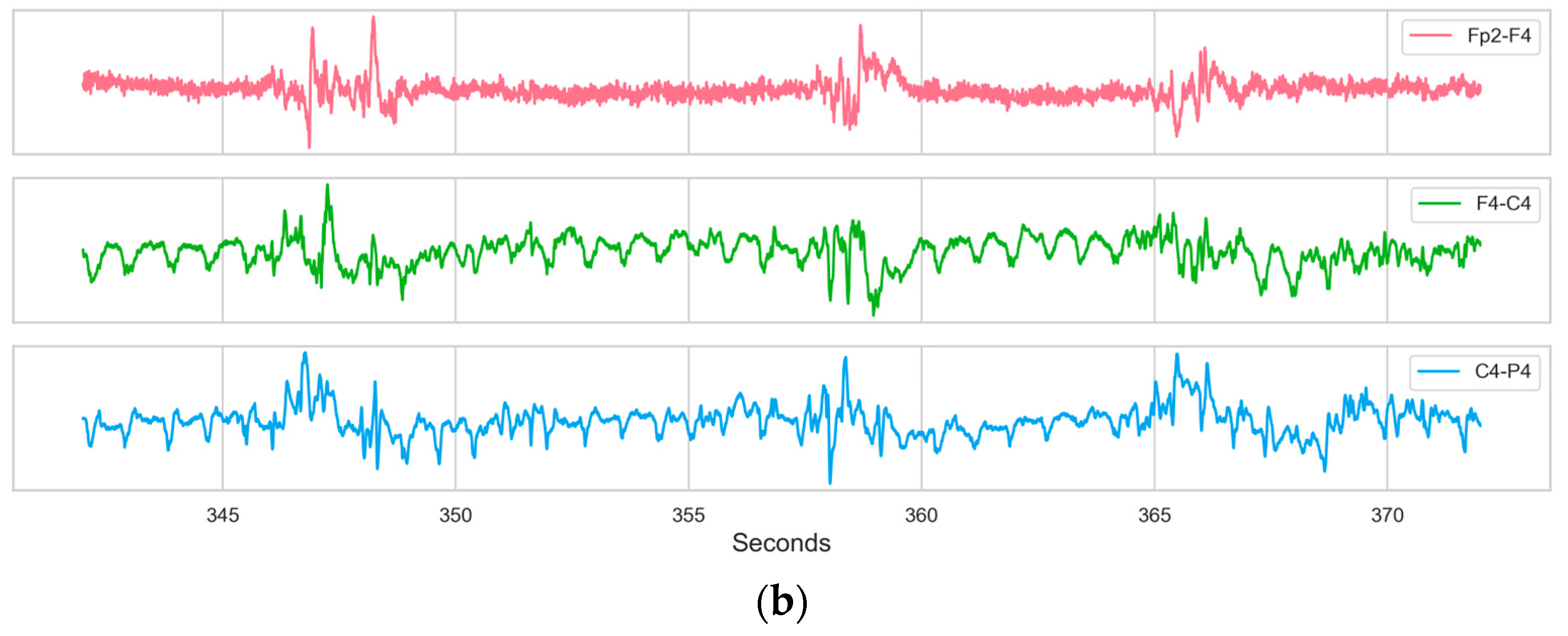 Electronics 13 02354 g002b