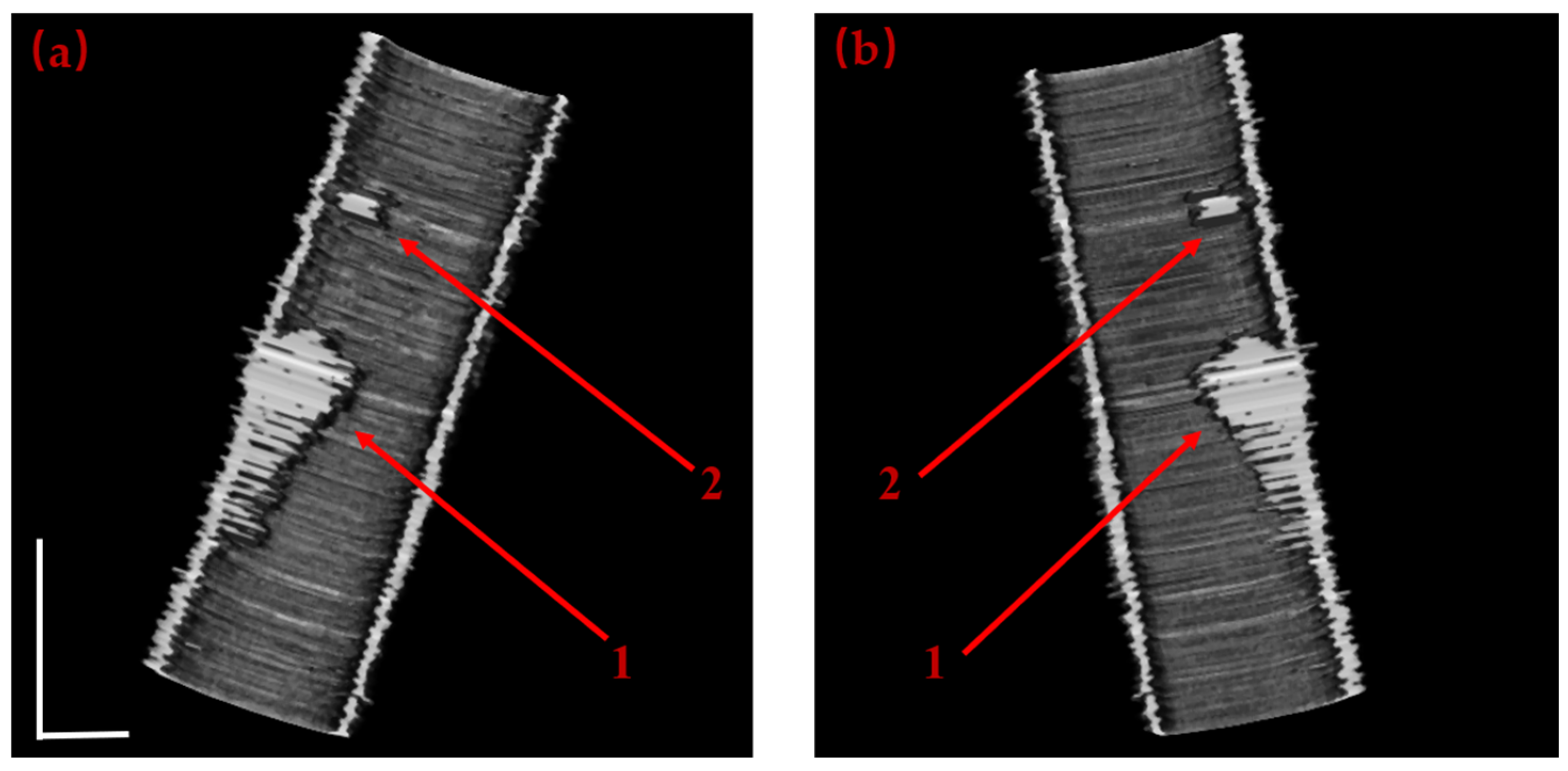 Boundary Segmentation of Vascular Images in Fourier Domain Doppler ...