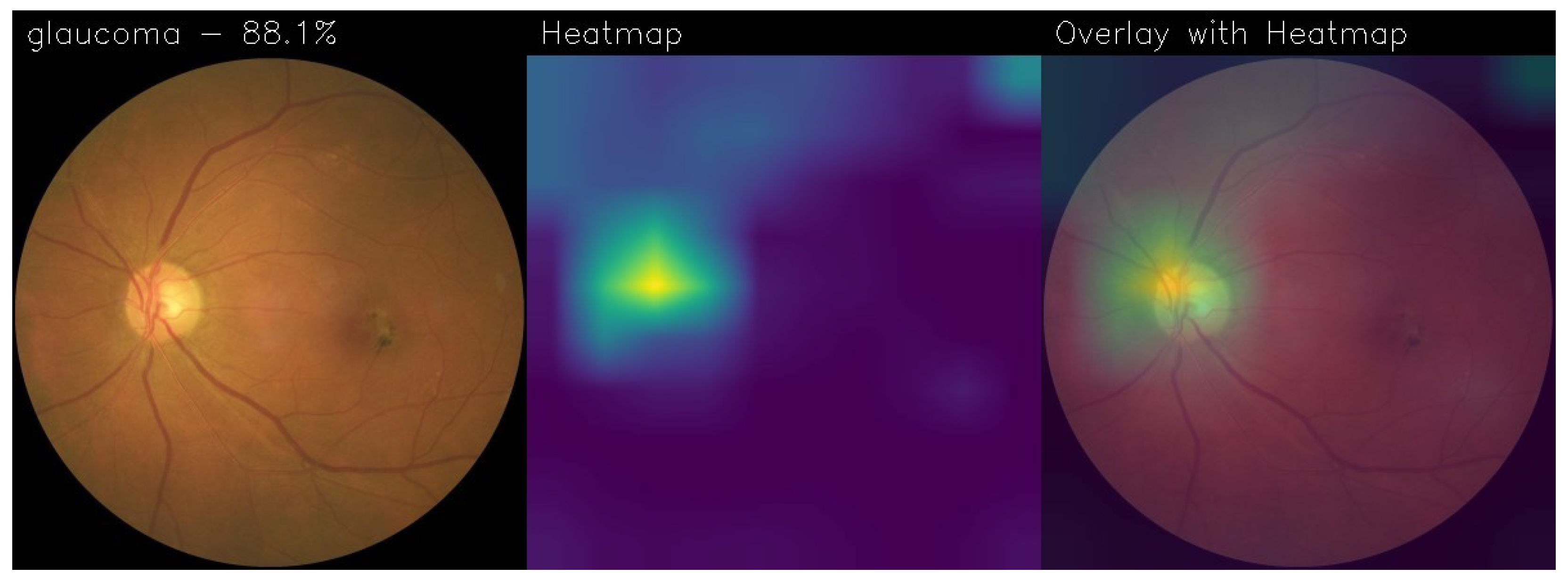 Electronics 13 02706 g017