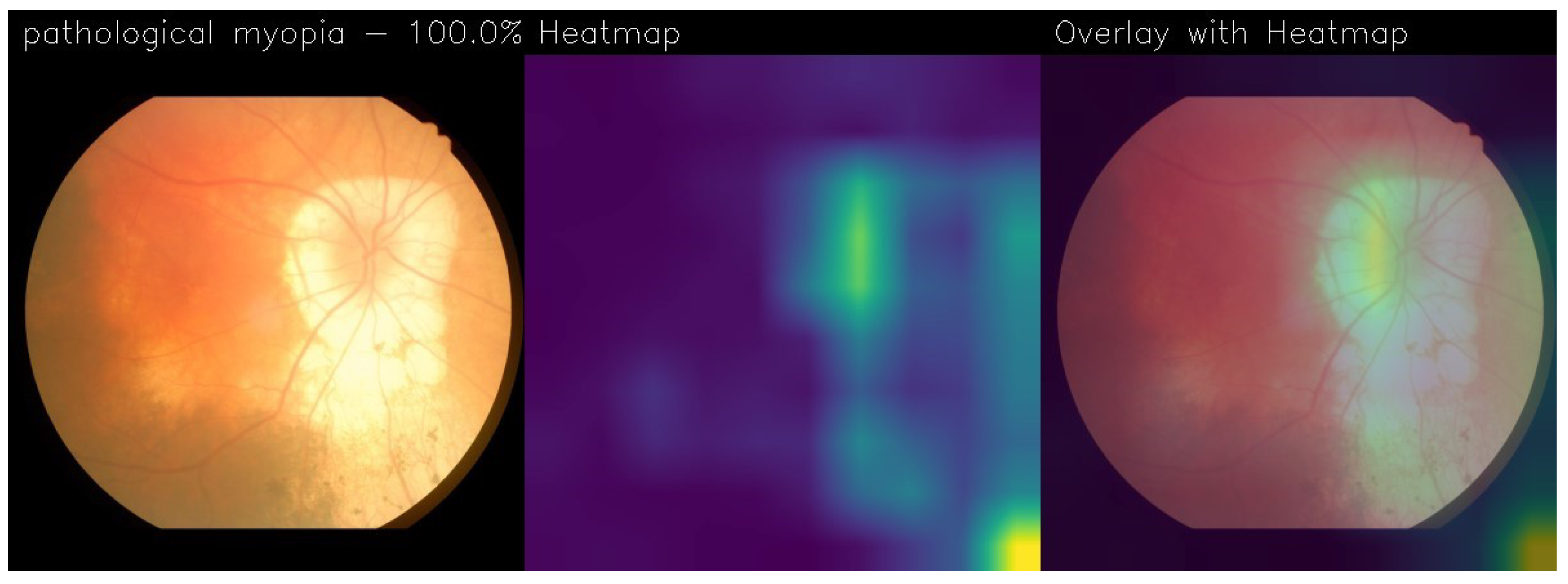 Electronics 13 02706 g023