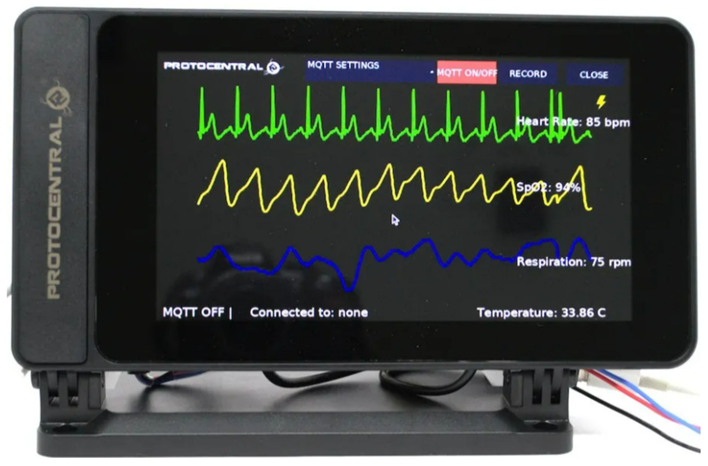 Electronics 13 02999 g013
