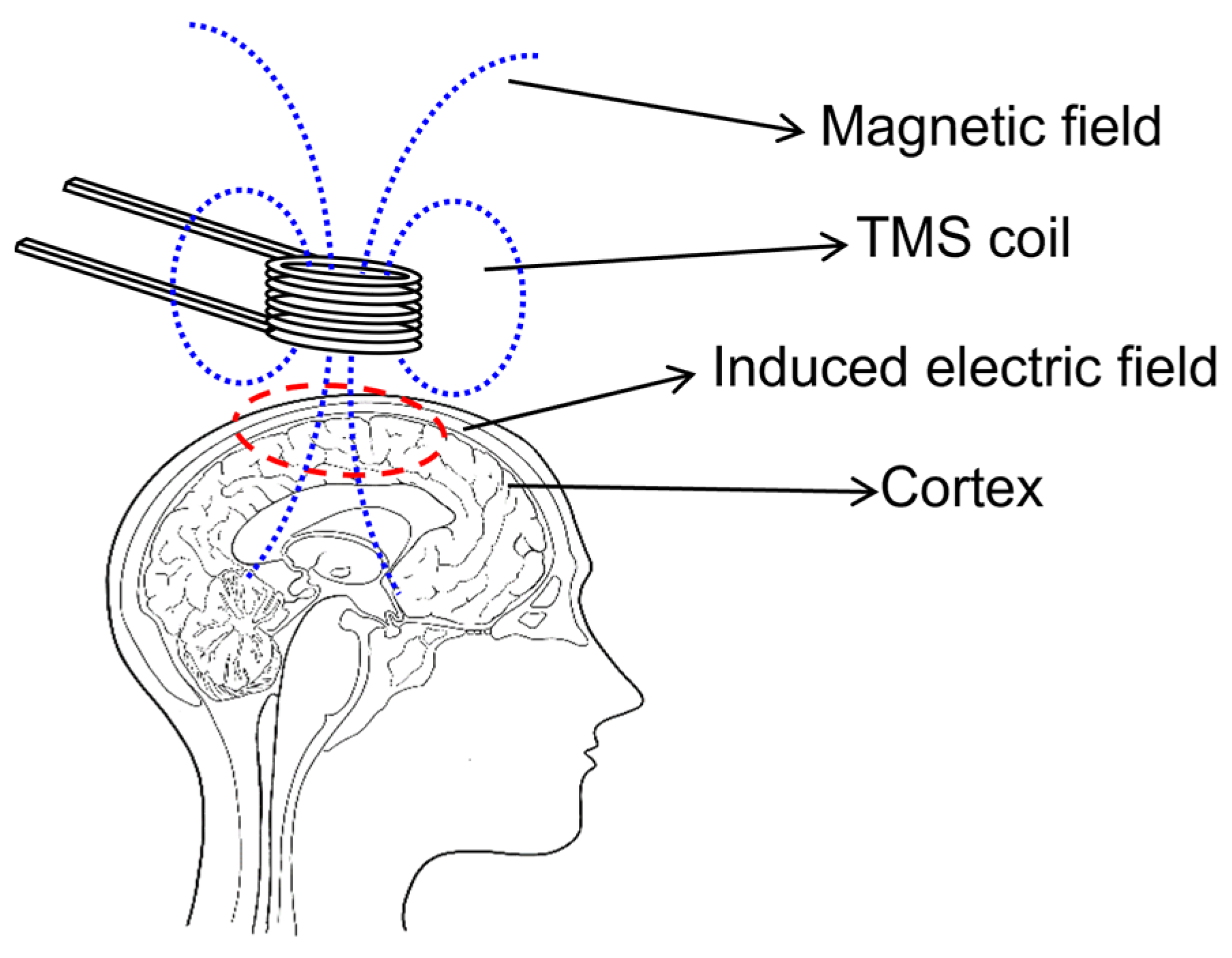 Electronics 13 03160 g001