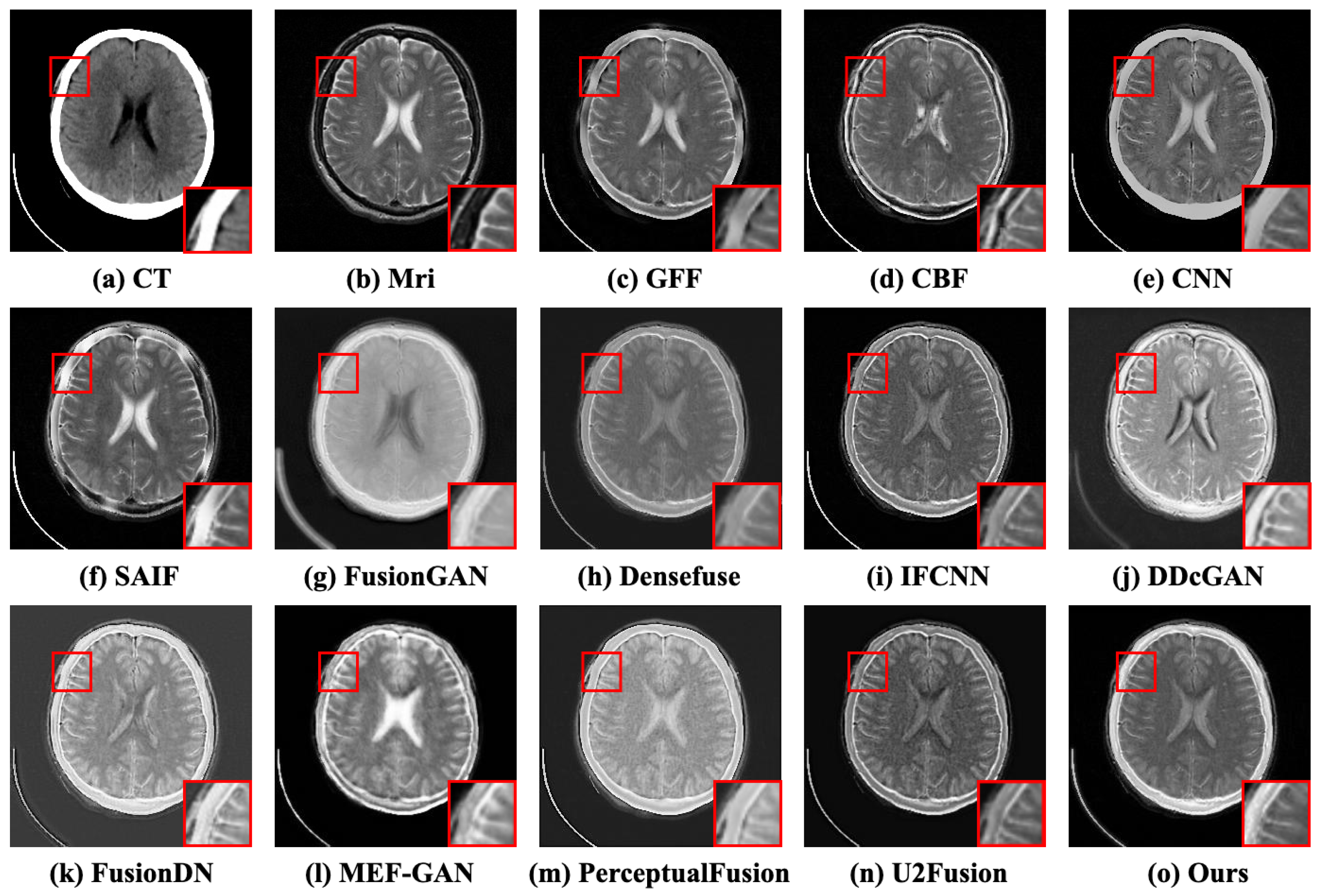 CT and MRI Image Fusion via Coupled Feature-Learning GAN