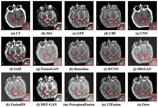 CT and MRI Image Fusion via Coupled Feature-Learning GAN
