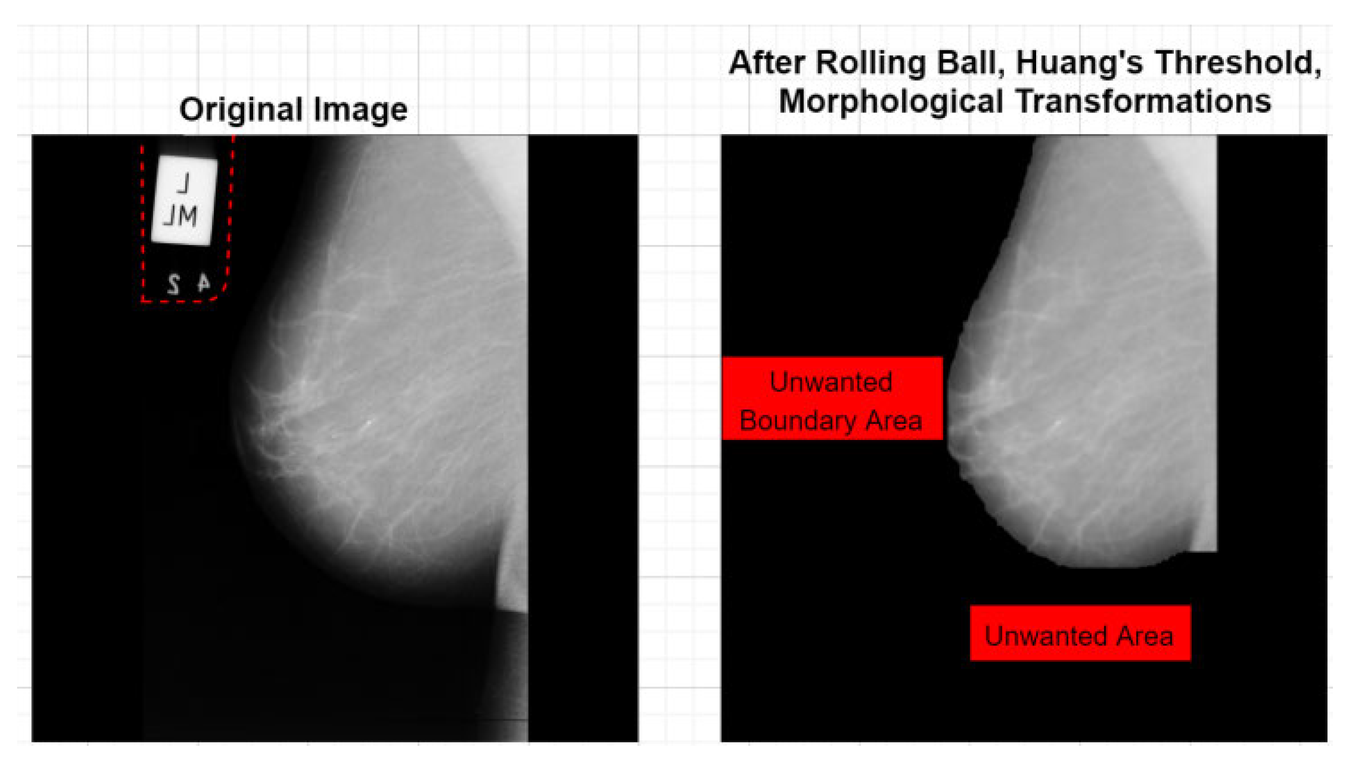 Electronics 13 03575 g004