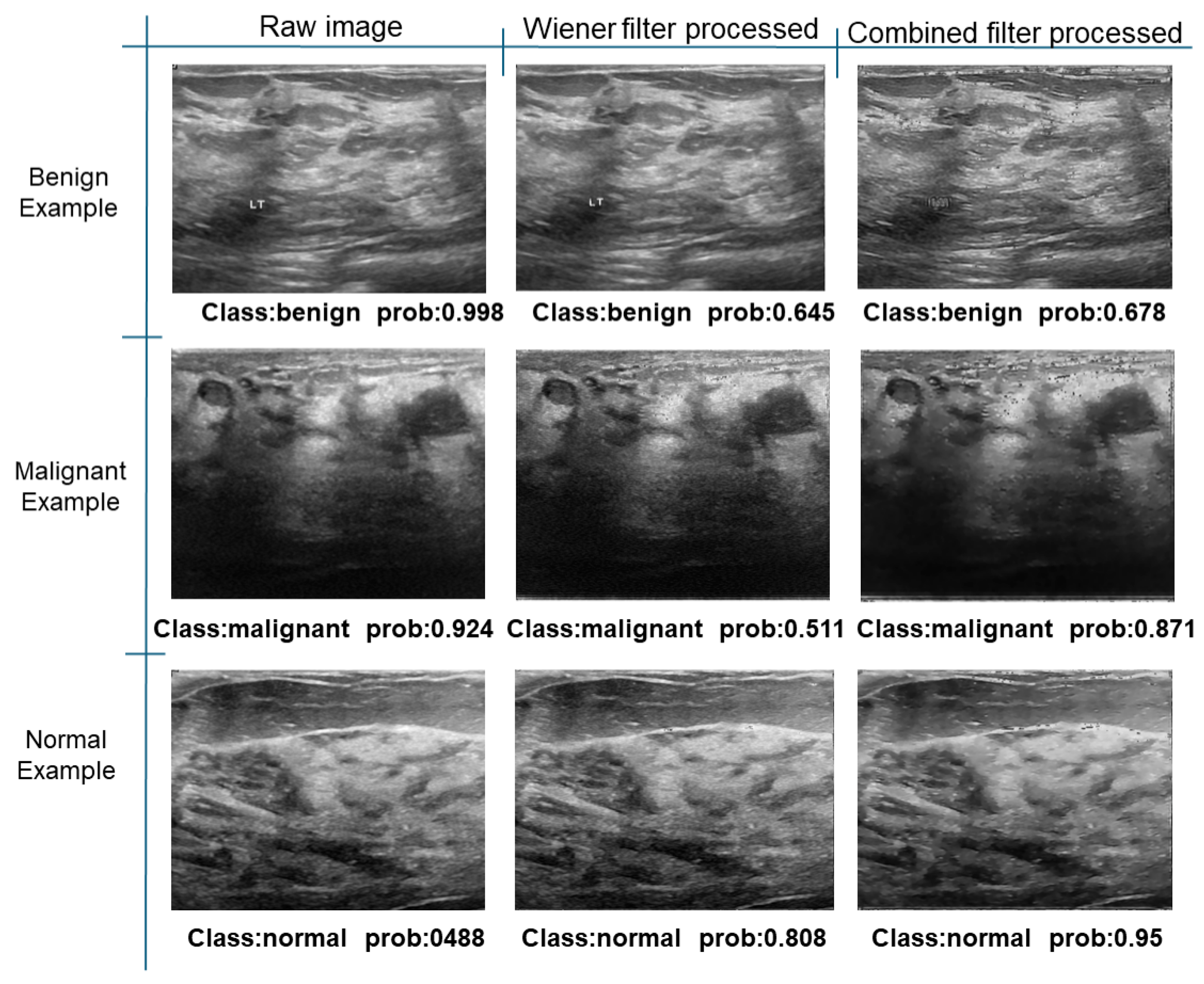 Electronics 13 03575 g033