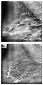 Electronics 13 03575 i007