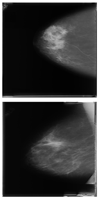 Electronics 13 03575 i013