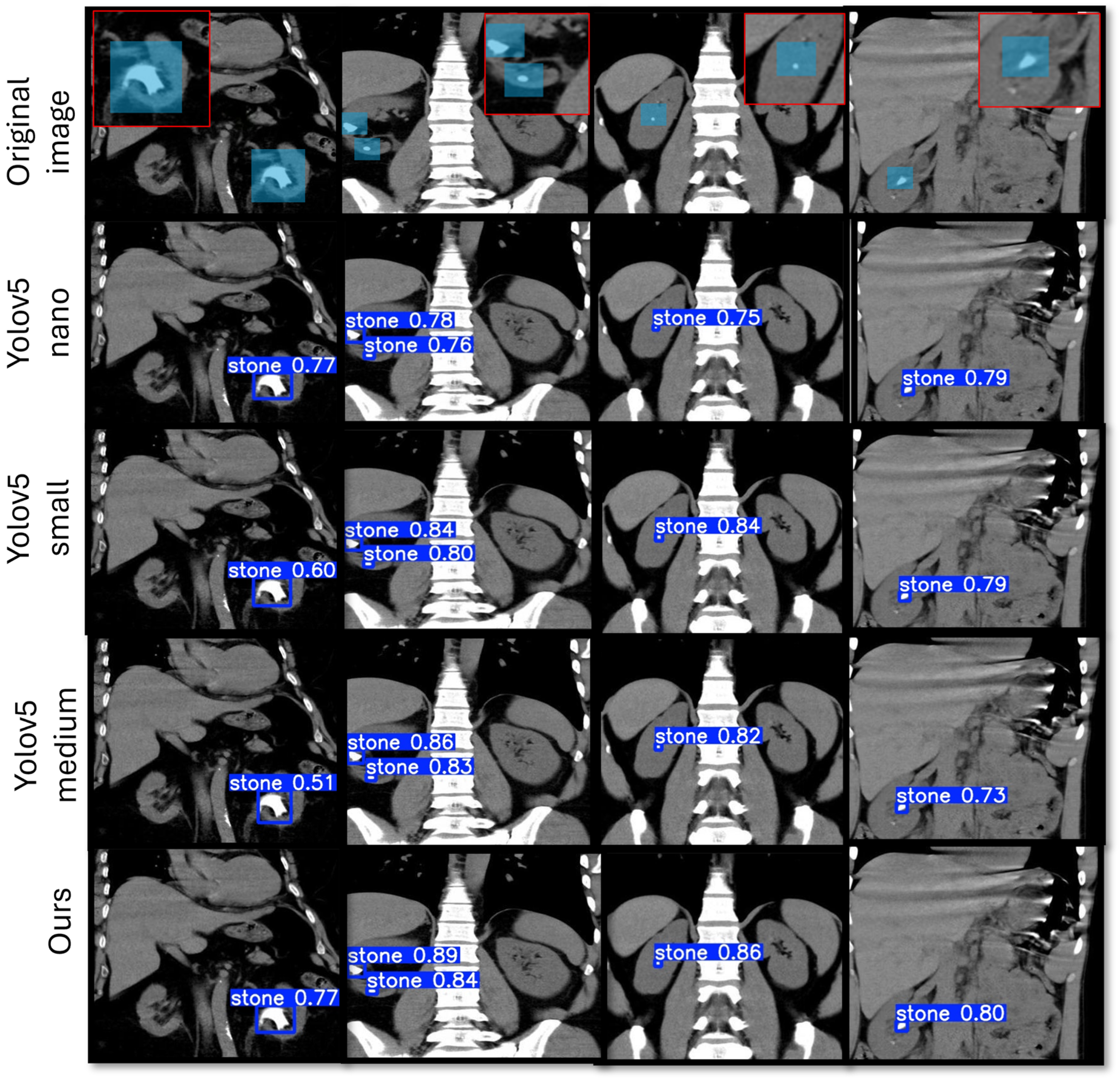 Electronics 13 04418 g003