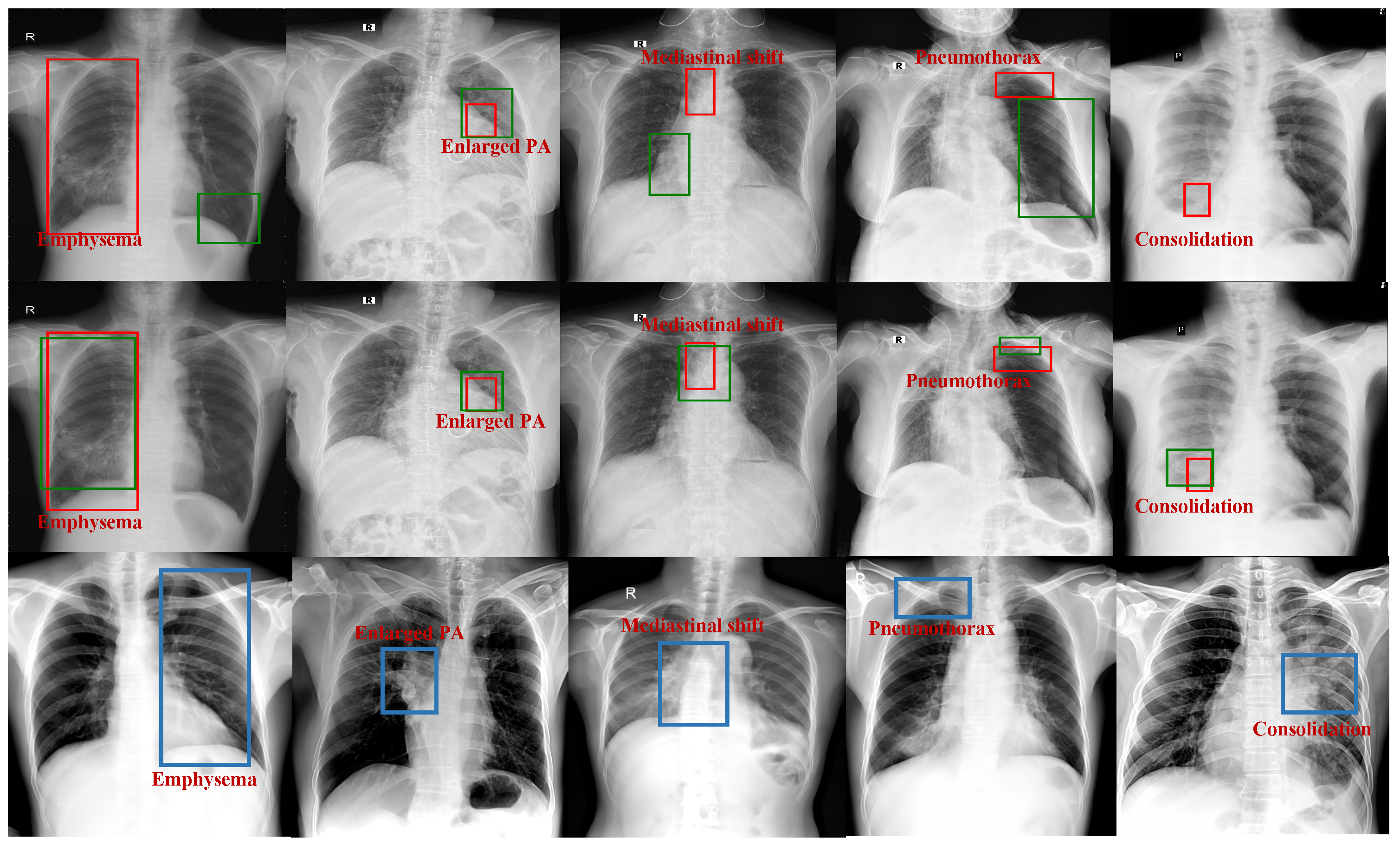 Electronics 13 04693 g006